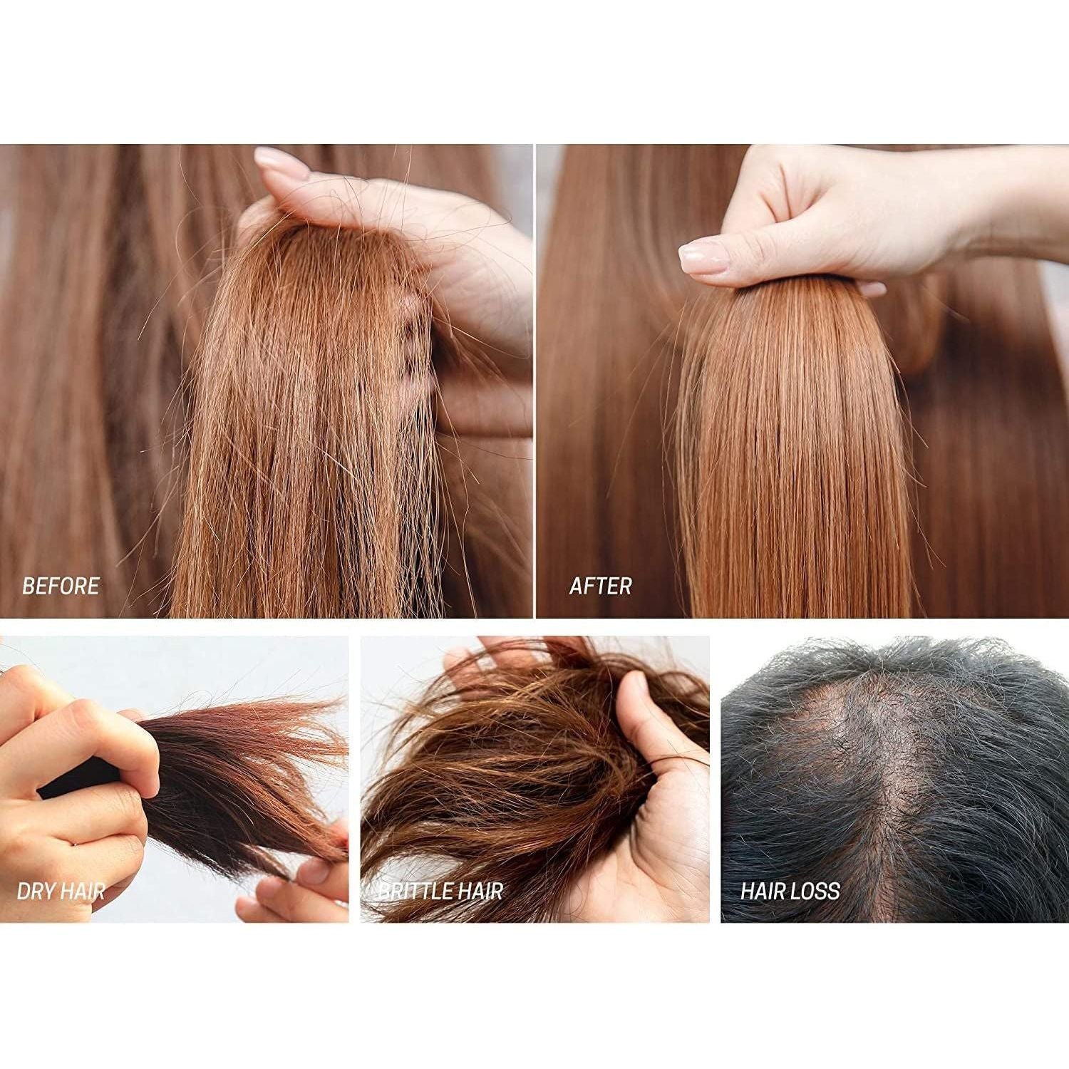 Biotin Hair Growth Oil Hair Growth Serum for Thicker Longer Fuller Healthier Hair, Prevent Hair Loss & Thinning, All Natural Vitamin Rich Treatment, Women & Men, All Hair Types 1.7 Oz