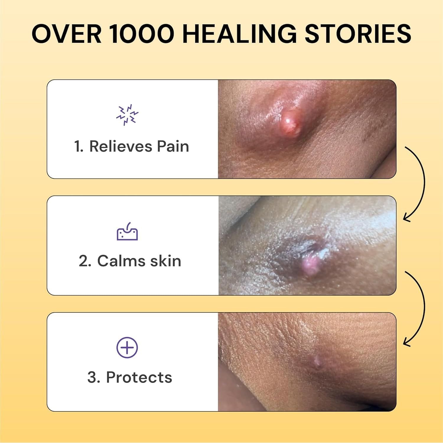 MyMagicHealer Universal Flare Care – 4oz (113g) | Natural Relief for HS, Boils, Abscesses & Skin Flare-Ups