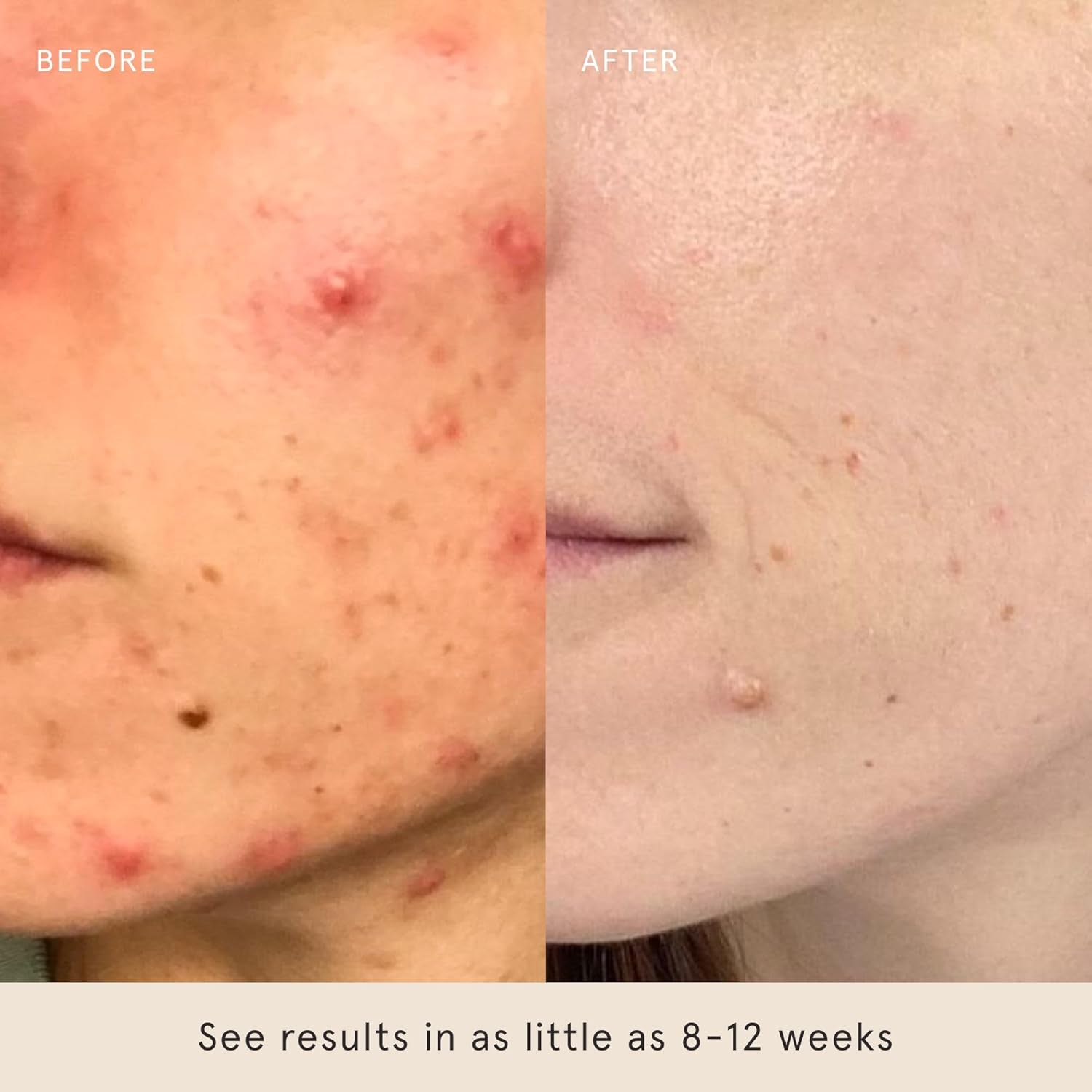 Toning Pads II (60 Count) Exfoliating and Resurfacing Face Pads W/ 5% Glycolic Acid & Salicylic Acid, Helps with Brightening & Cleansing Skin, Clears Pores, Reduces Fine Lines and Wrinkles