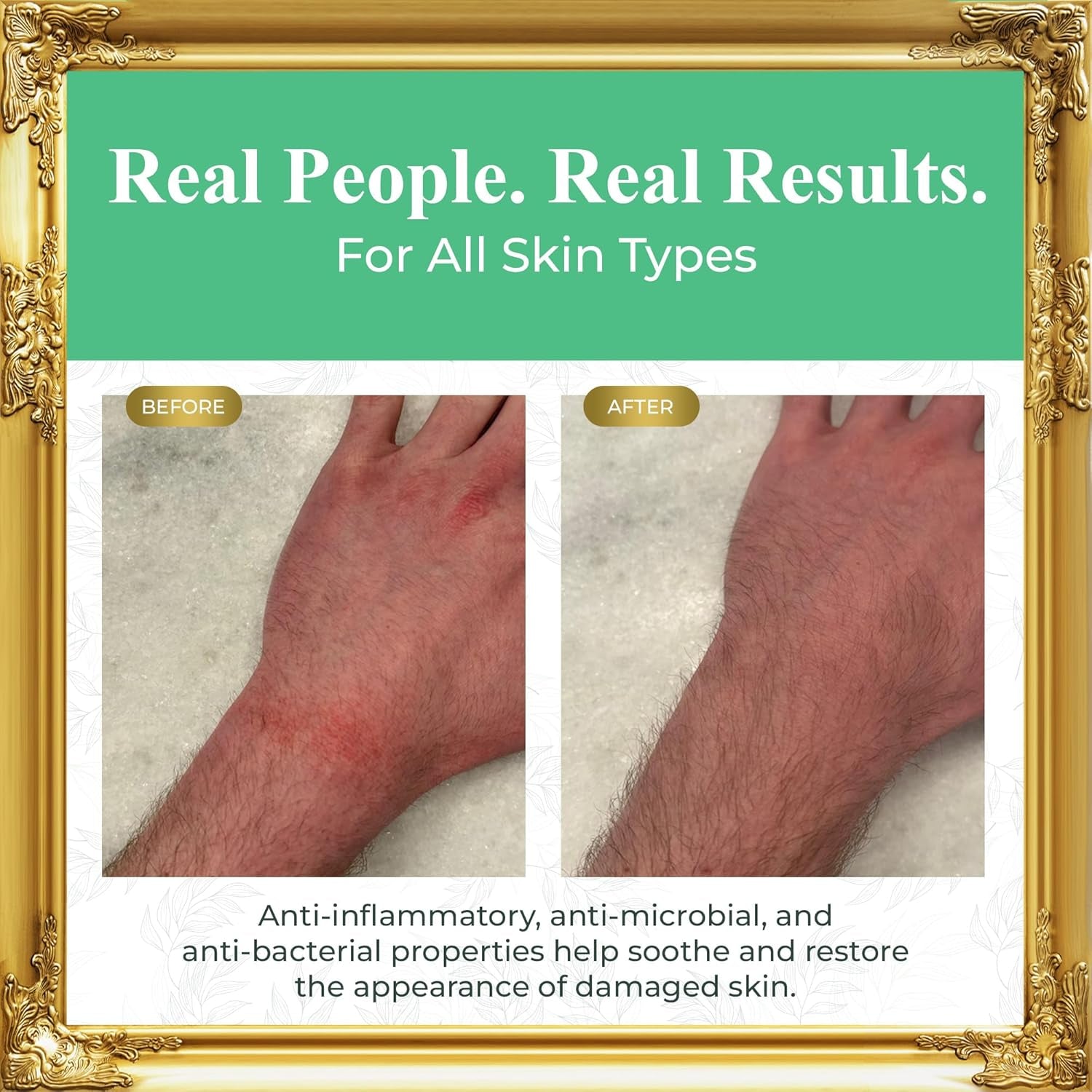 Whipped Tallow and Honey Balm (Unscented), Beef Tallow for Skin Care, Grass Fed + Finished Tallow Moisturizer Cream for Face & Body W/Organic Honey, Aloe Vera, Jojoba Oil, Men Women 3.25Oz