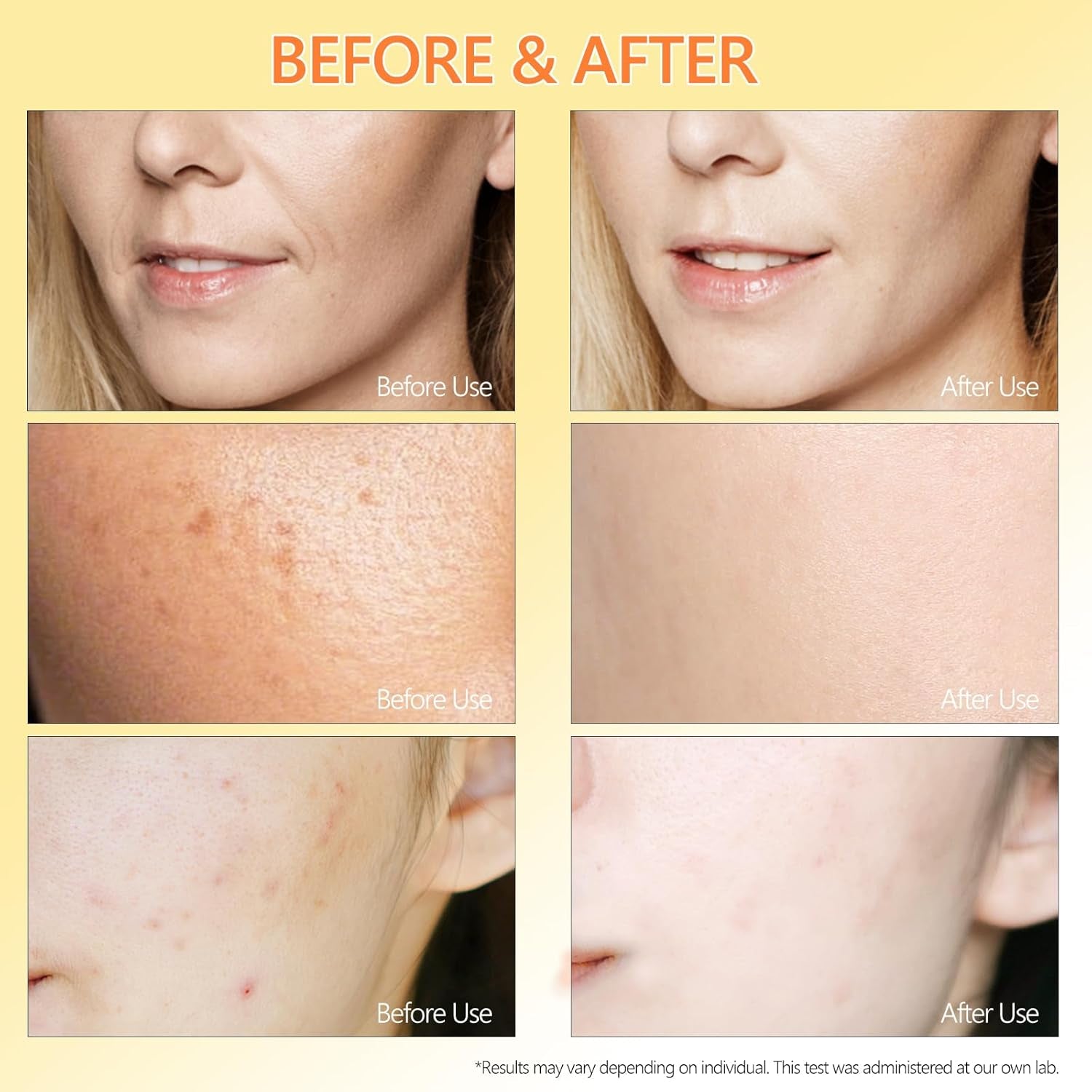 ABOTE Facial Serum – 120ml | Anti-Wrinkle, Brightening & Barrier-Repair Formula