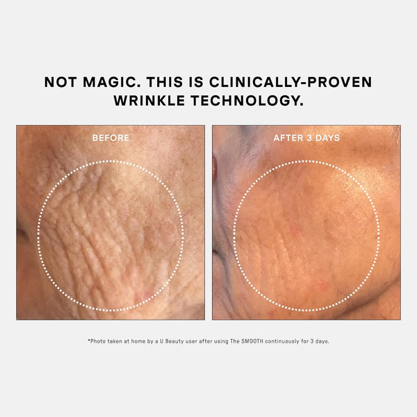 U Beauty THE SMOOTH Dynamic Wrinkle Defense Serum – 30ml | Multi-Peptide Anti-Aging & Firming Treatment