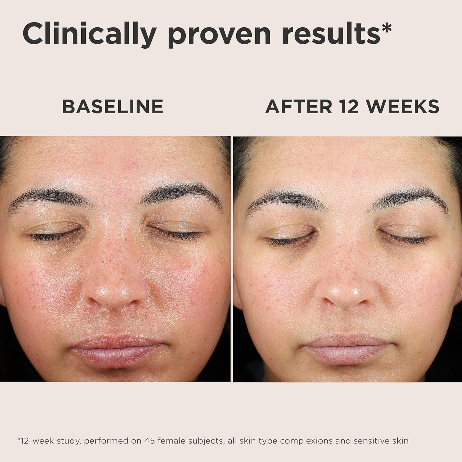EltaMD UV Skin Recovery Face Sunscreen SPF 50 – 48g | Broad-Spectrum Protection for Sensitive, Stressed Skin