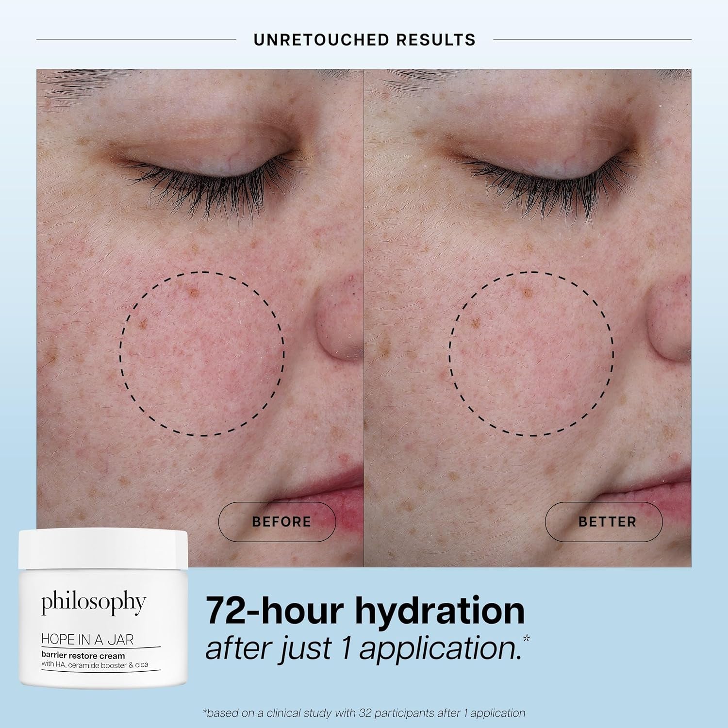 philosophy Hope In A Jar Barrier Restore Cream – 60ml