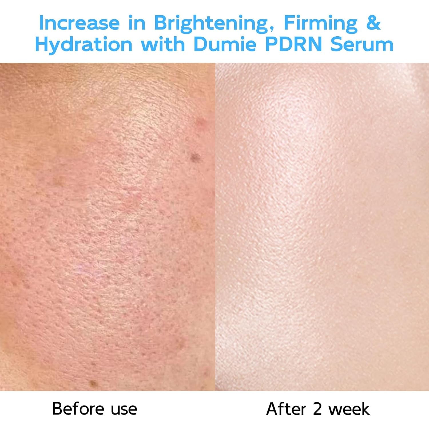 Dumie PDRN DNA Anti-Aging Serum – 30 x 1.5ml Capsules | Salmon DNA Repair, Deep Hydration & Radiance Boost