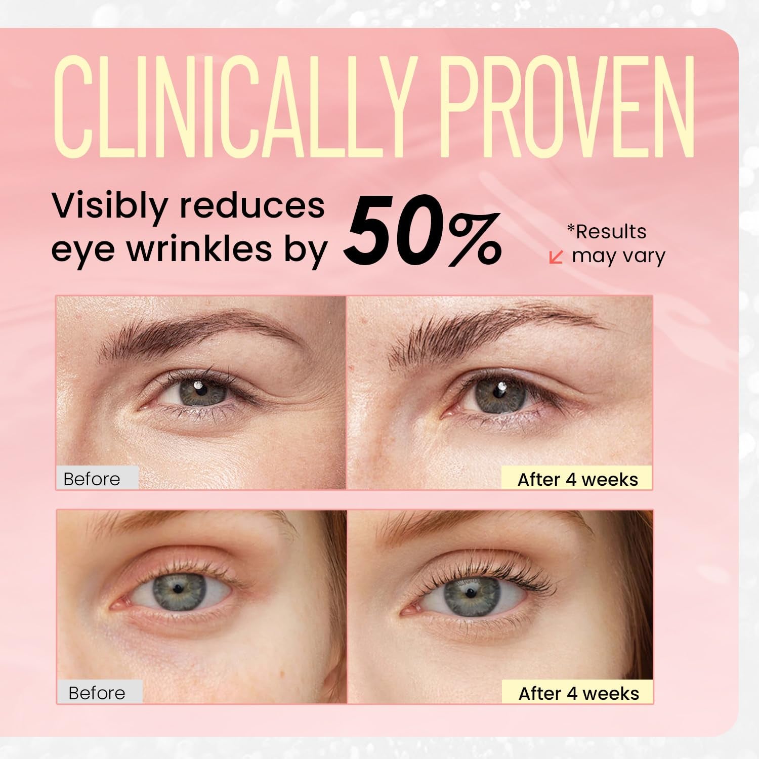 RONKIE Revive Eye Serum – 20ml | Retinol & Niacinamide Anti-Aging Eye Treatment