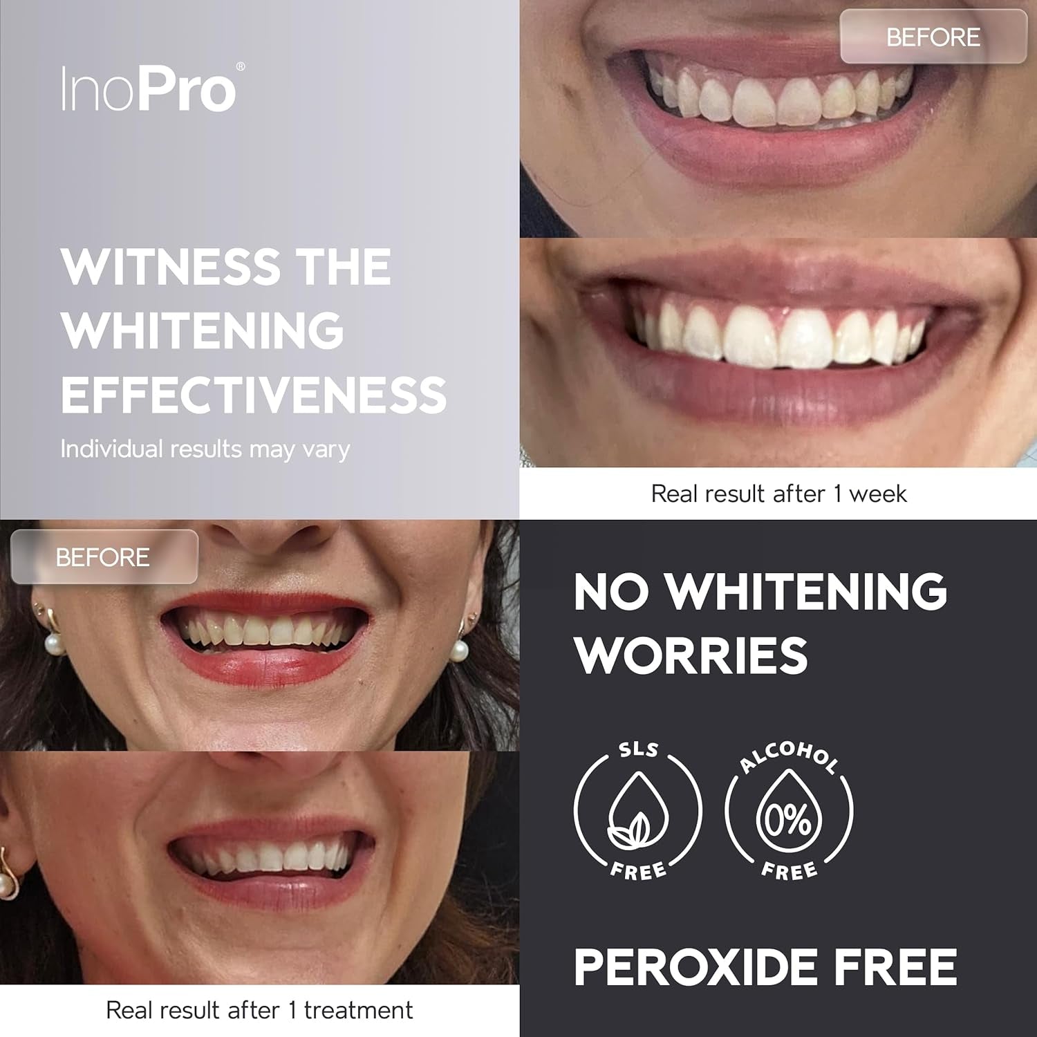 InoPro Advanced Teeth Whitening Strips – 21 Treatments (42 Strips) | Professional Whitening, Stain Removal & Enamel Care