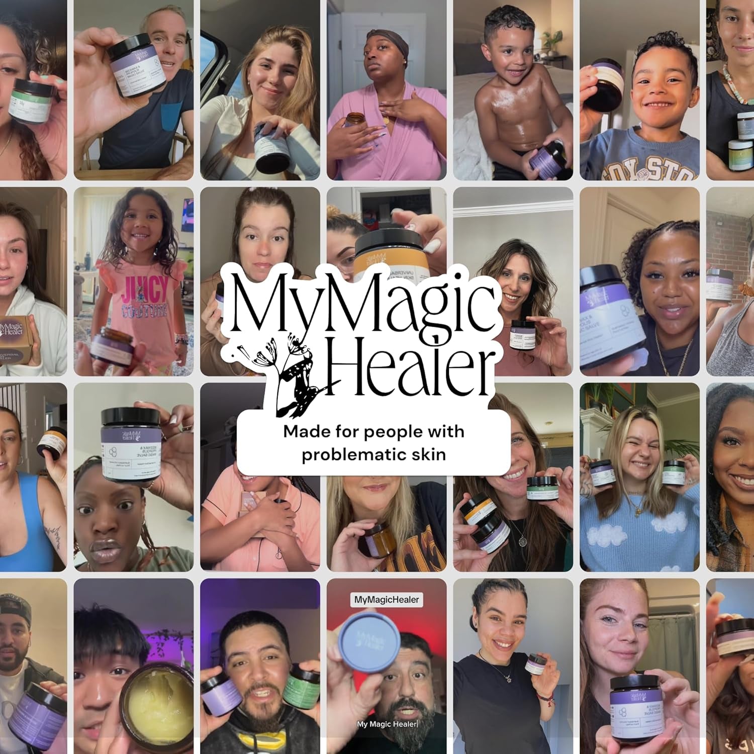 MyMagicHealer Universal Flare Care – 4oz (113g) | Natural Relief for HS, Boils, Abscesses & Skin Flare-Ups