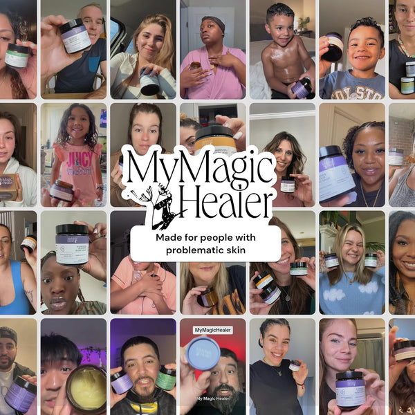 MyMagicHealer Universal Flare Care – 4oz (113g) | Natural Relief for HS, Boils, Abscesses & Skin Flare-Ups