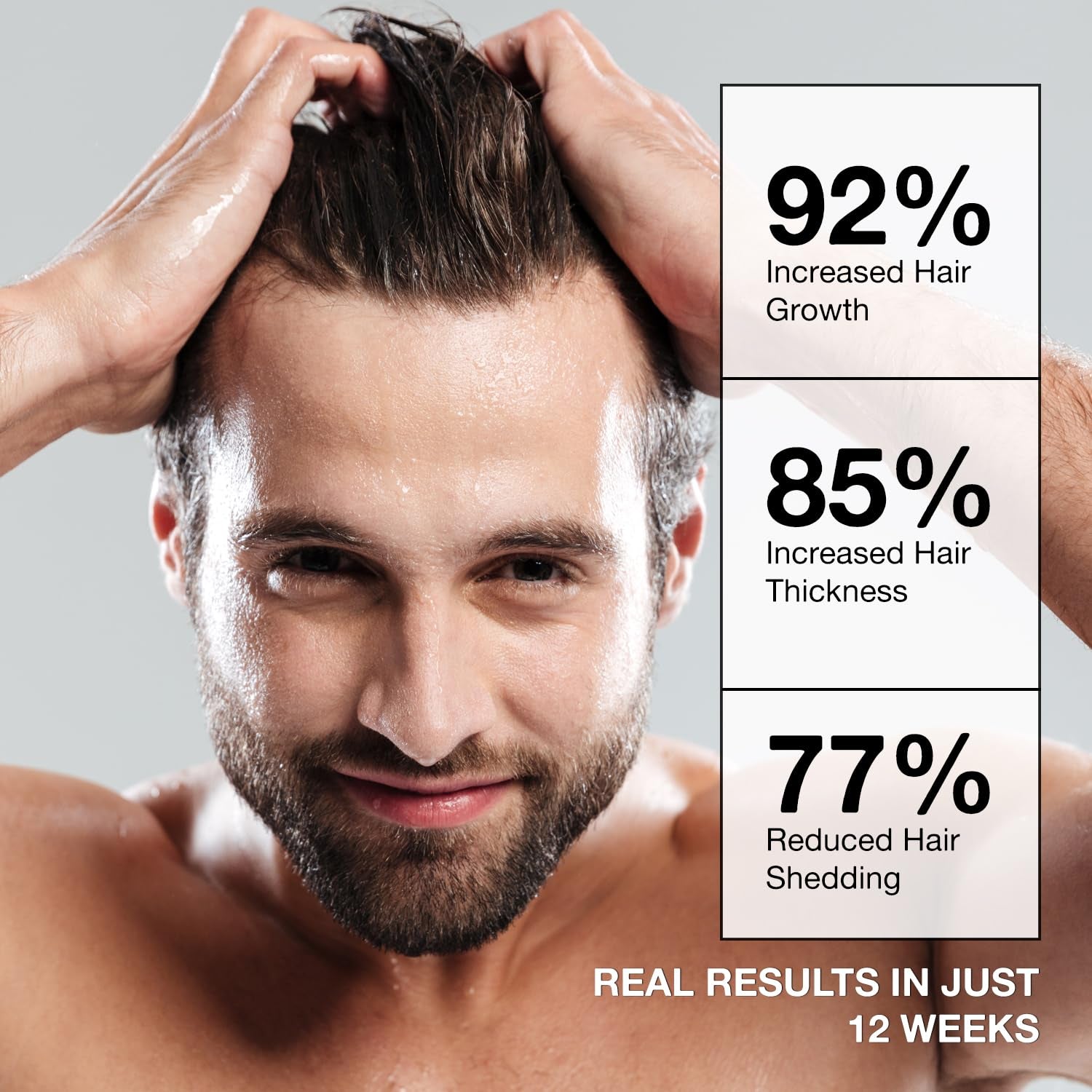 Beadlamey Root Activator Shampoo – 300ml | Men’s Hair Growth & Scalp Health