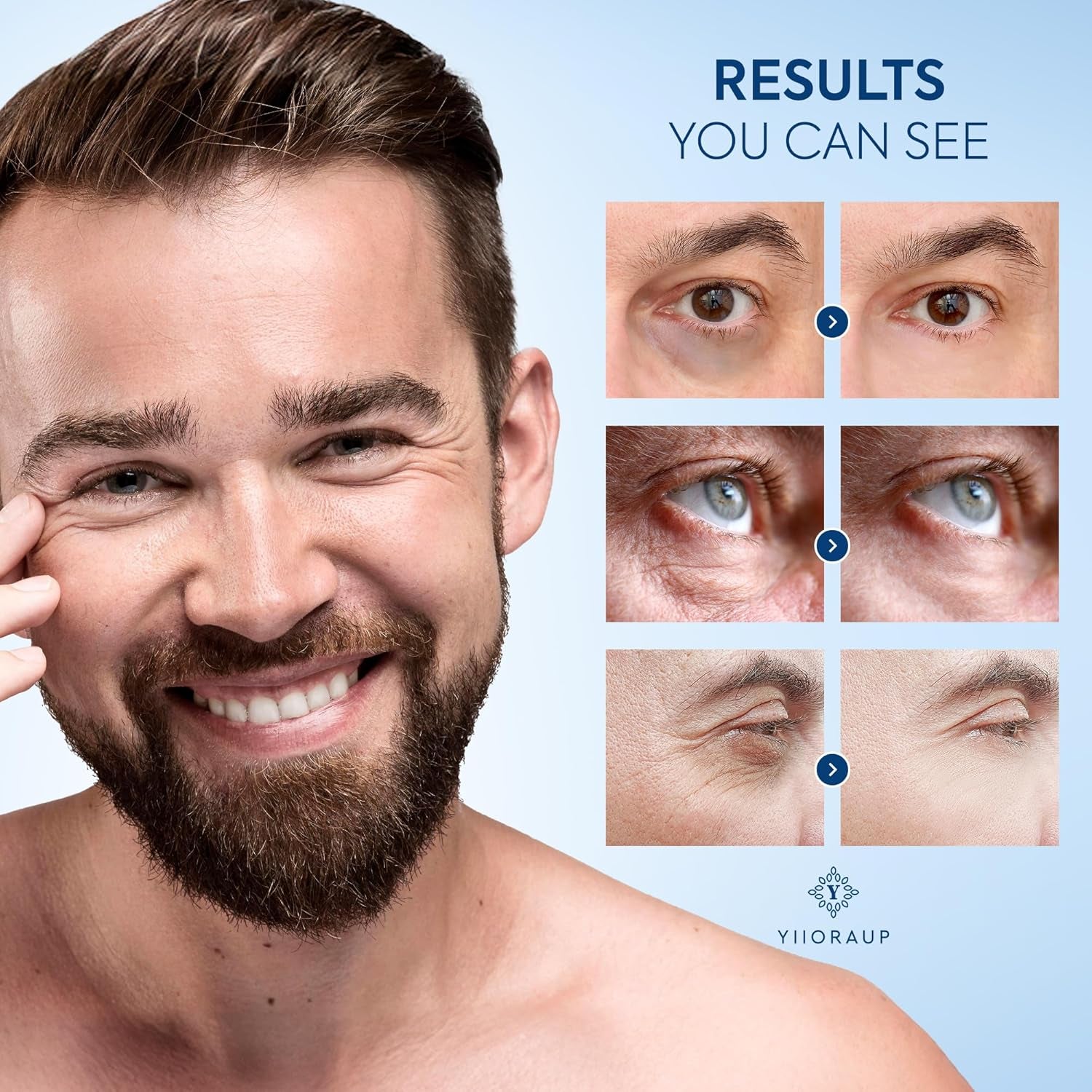 YIIORAUP Caffeine Eye Serum – 15ml | Men’s Under-Eye Bag & Dark Circle Treatment