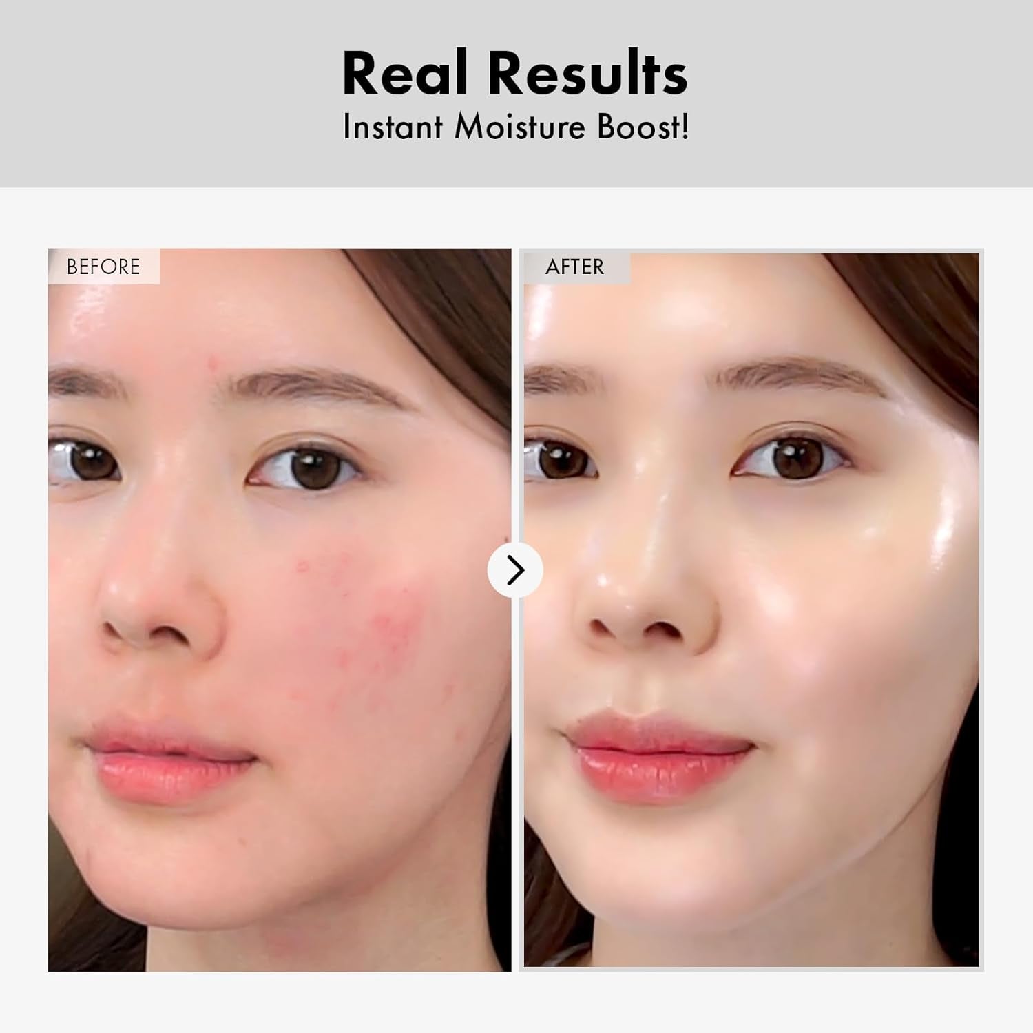 Hyaluronic Acid Ampoule, Hydrating Glow and Skin Barrier Protection, Anti-Aging Face Serum for Dry Skin, Korean Skincare Beauty Products, 100Ml, 3.38 Fl. Oz.