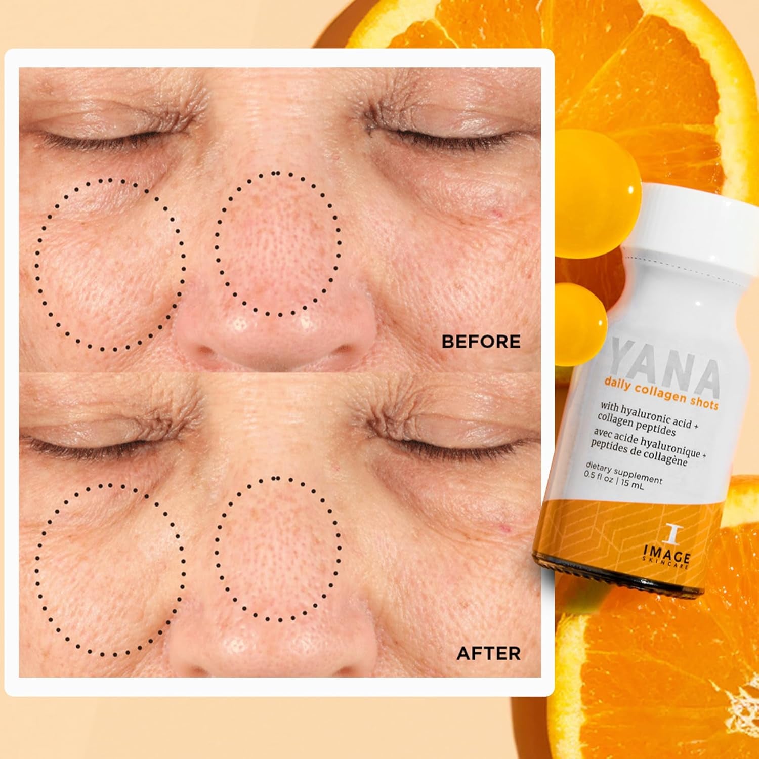IMAGE Skincare YANA Liquid Collagen Shots – 15ml | Radiance-Boosting Daily Collagen Supplement for Firmer, Glowing Skin
