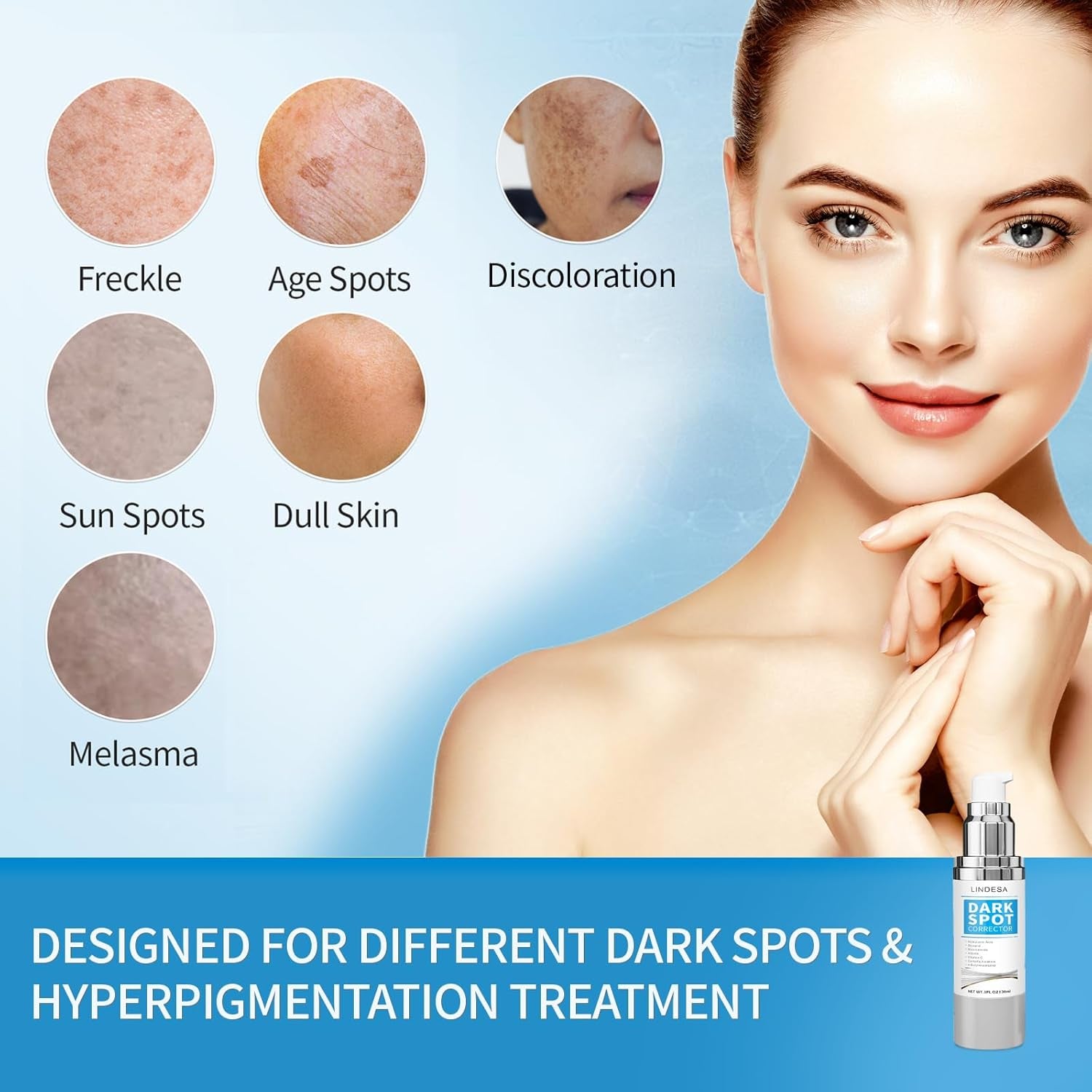 Lindesa Dark Spot Corrector – 30ml | Advanced Serum for Hyperpigmentation, Melasma, Sun Spots & Uneven Skin Tone