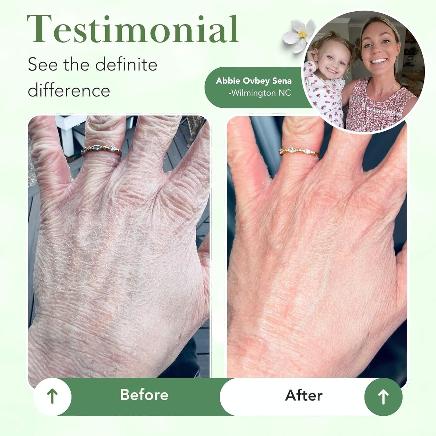 Theraplex Barrier Balm - 170.1g