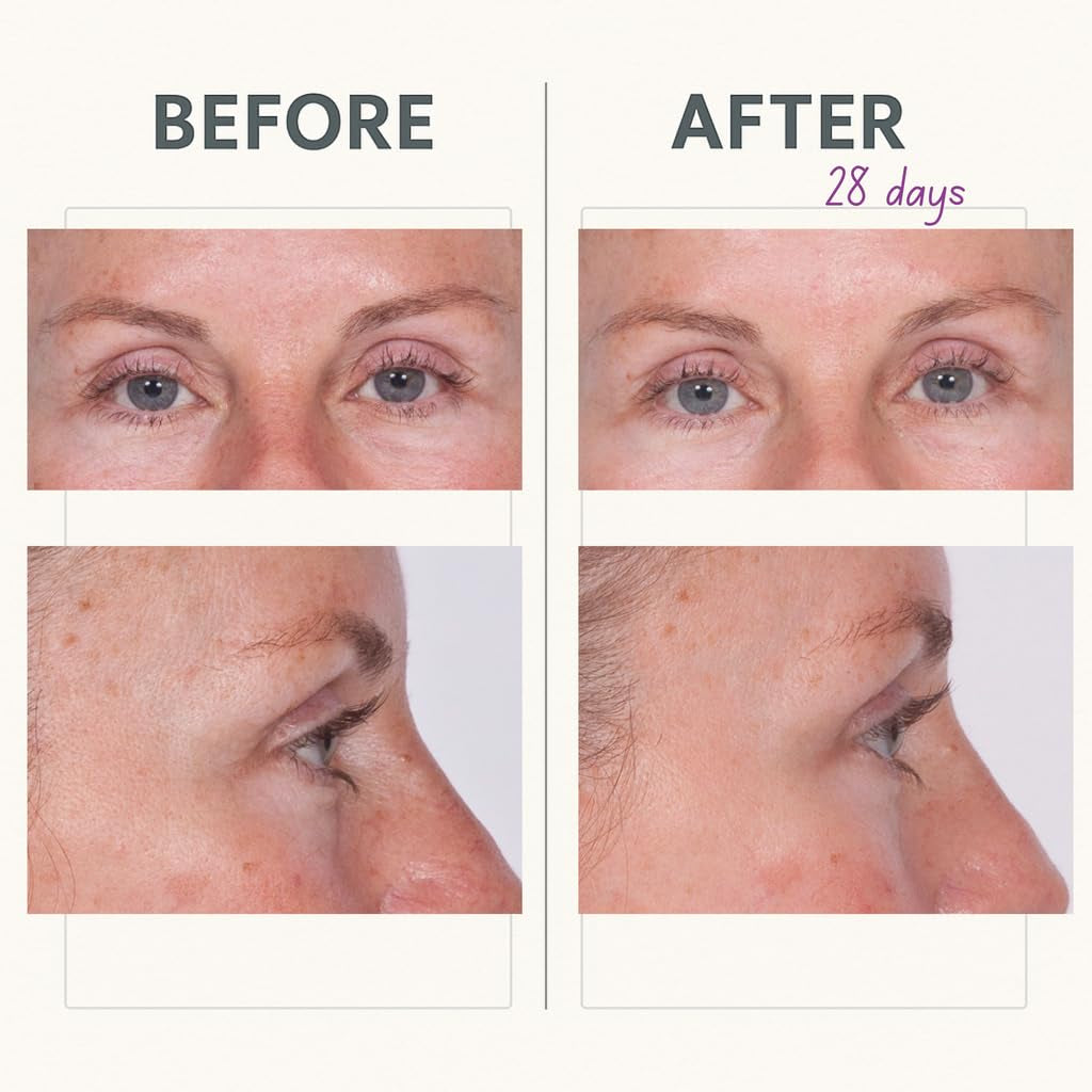 Reverse Lift Tightening Eye Cream with Peptides, Hydrating Anti-Aging, Temporarily Lift Eyelids, Eyebrow, under Eye Skin Firming Wrinkle Formula, Women, Men,1 Fl. Oz.