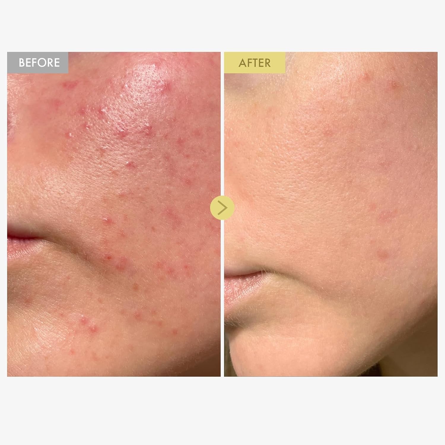 Black Snail Mucin 92% Face Cream, 920,768Ppm Black Snail Mucin, Propolis, Lightweight Moisturing Cream for Soft, Glowy Skin, Moisturizer Face Cream, Korean Skin Care, 100Ml, 3.38 Fl.Oz.