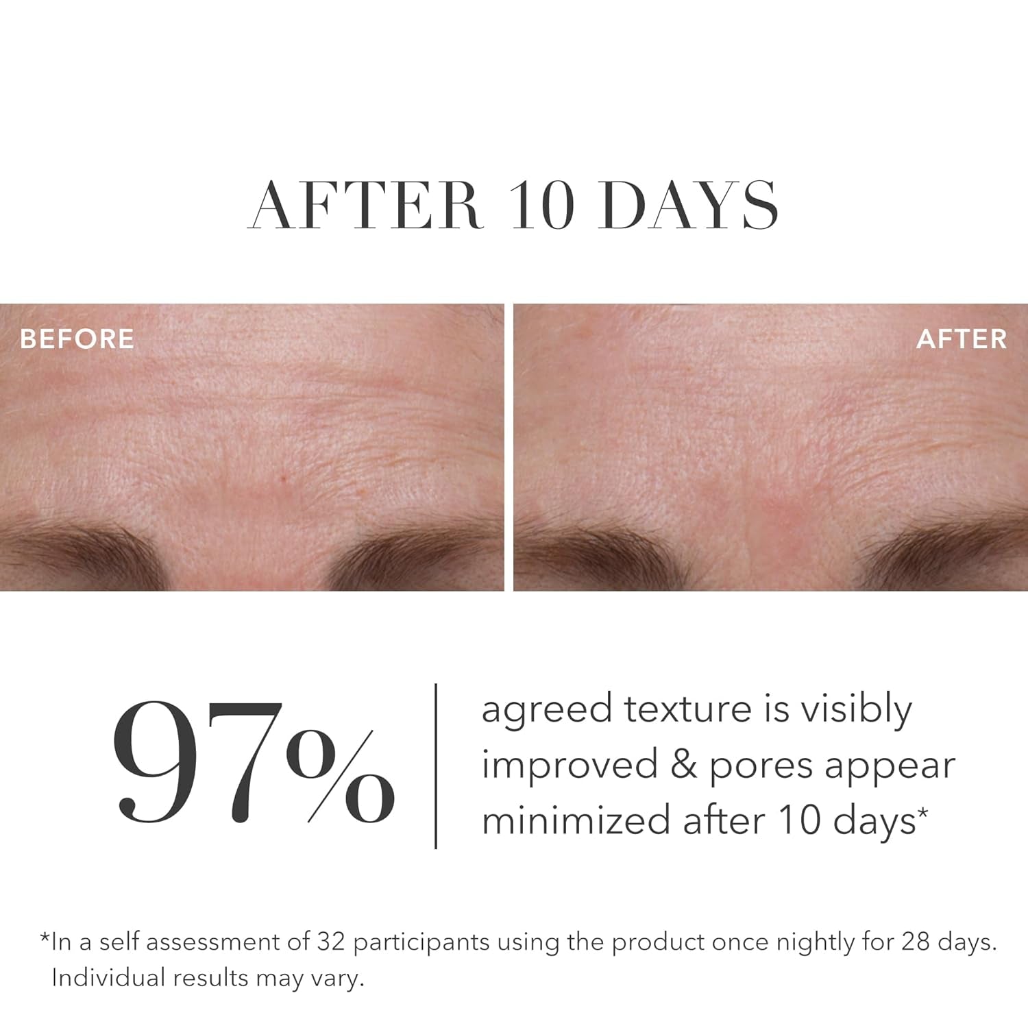 Algenist Green Microalgae Retinol+ Regenerating Serum – 30ml | Gentle Plant-Based Retinol for Smoother, Brighter Skin