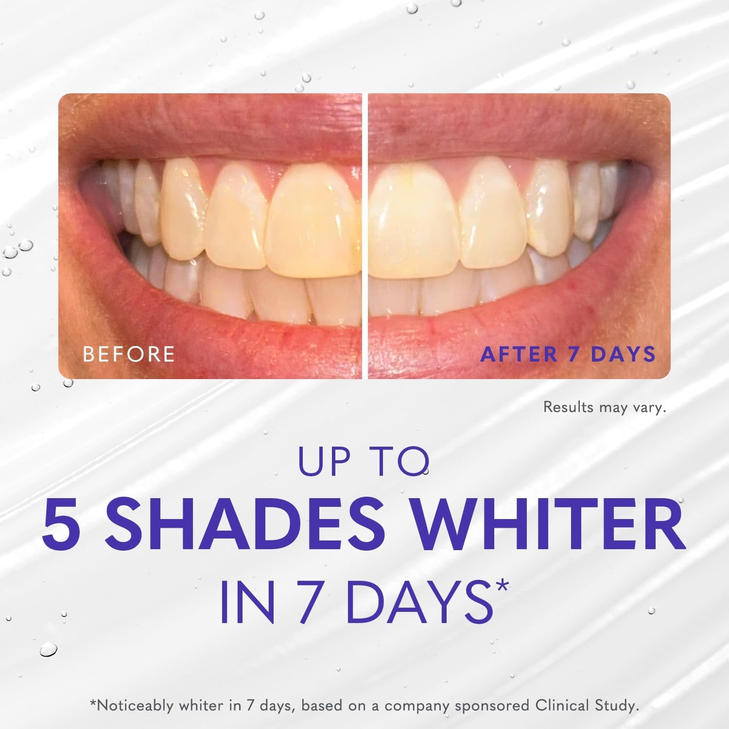 Smileactives Pro Whitening Gel – 60ml | Fast-Acting Hydrogen Peroxide Teeth Whitener