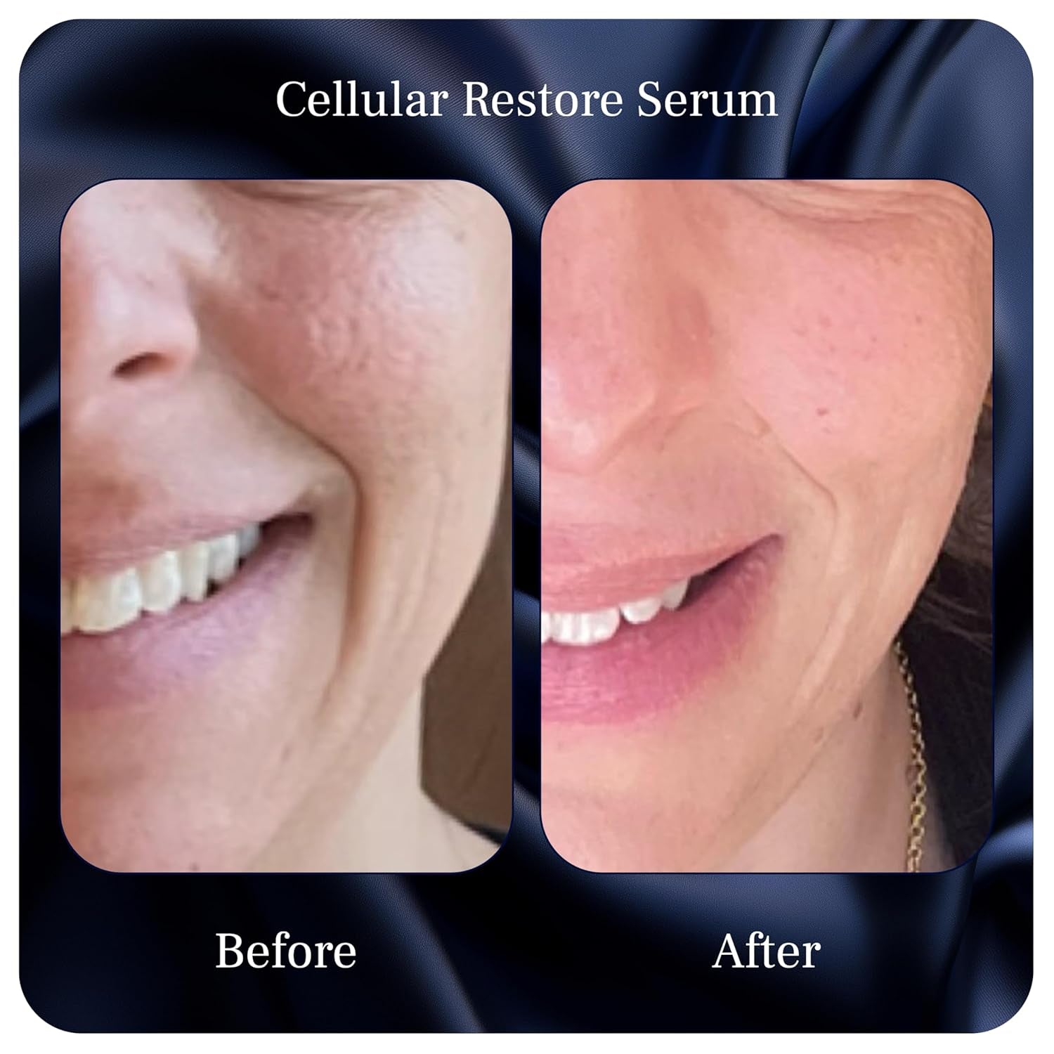 Organic Bakuchiol Plumping Serum - Bakuchiol for Face Skin and Wrinkles - Cellular Restore Serum - with Jojoba Oil, Sea Buckthorn, Camu Camu, Babchi, Maple Leaf Extracts & More - 1 Fl Oz