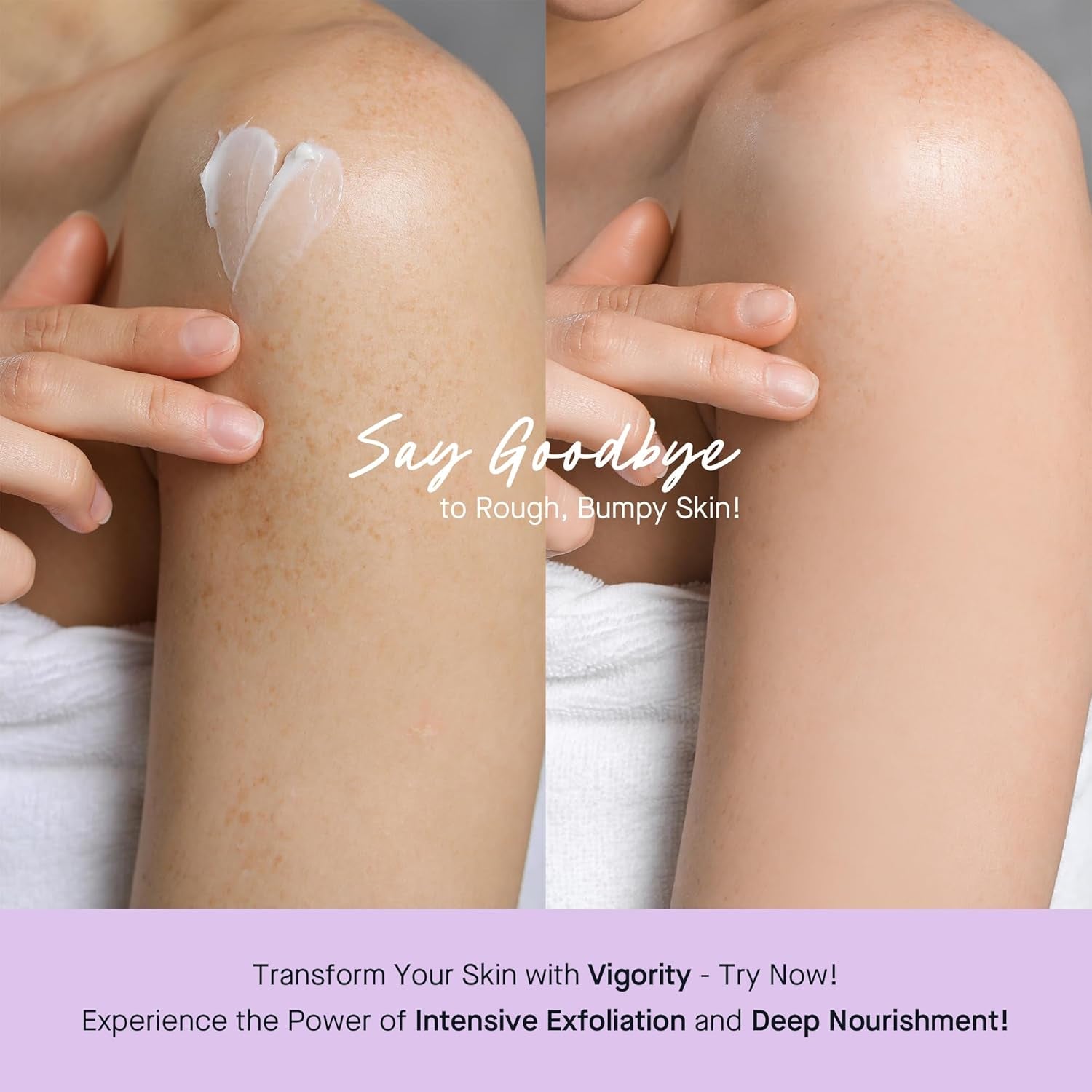 Vigority KP Bump Eraser Body Cream - 150ml