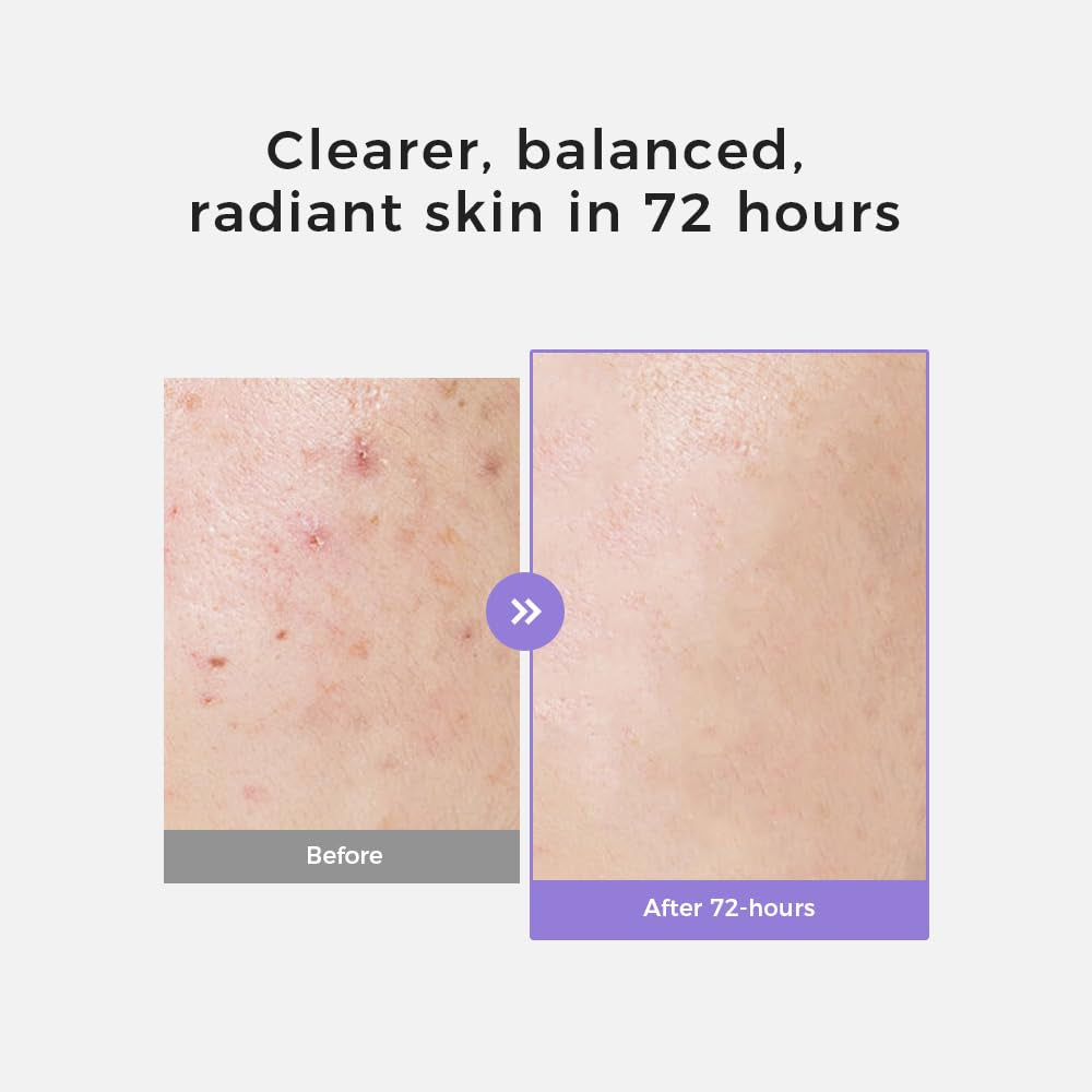 Suquato Dark Spot Correcting Glow Serum – 30ml | Brightening Treatment for Hyperpigmentation, Melasma & Uneven Skin Tone