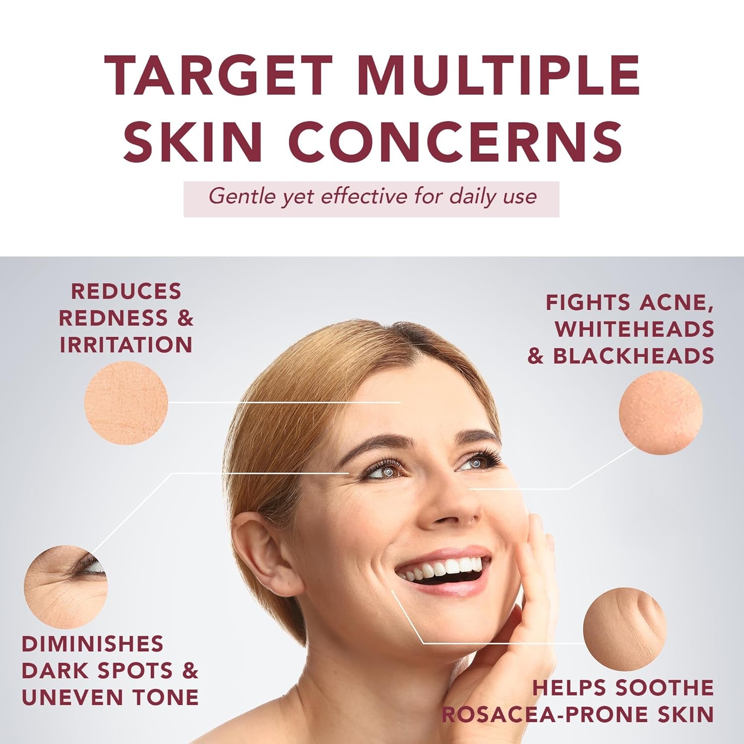 Suquato 10% Azelaic Acid Serum – 30ml | Redness-Relief & Brightening Serum for Clear, Even Skin
