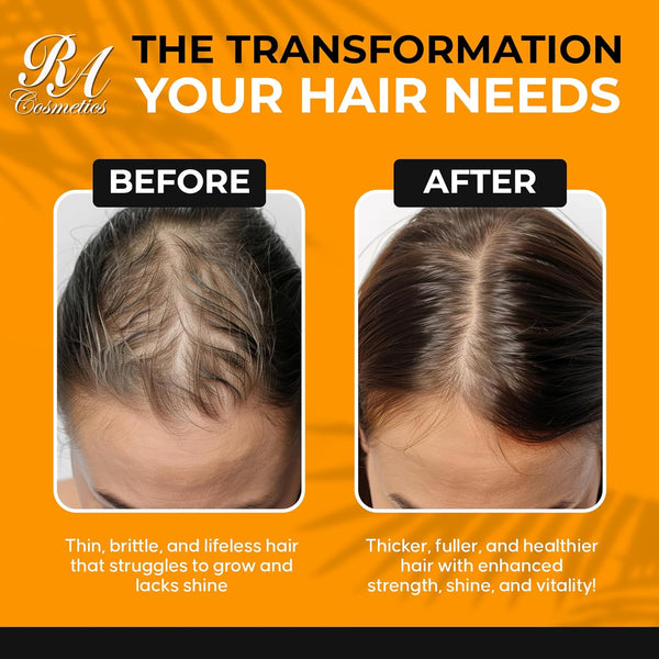 RA COSMETICS 100% Raw Batana Oil – 236.59ml | Strengthen Hair, Restore Shine & Nourish Scalp