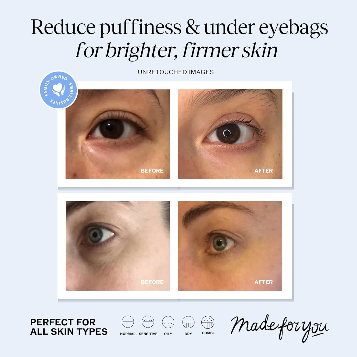 LilyAna Naturals Eye Cream – 48g | Hydrating Anti-Aging Treatment for Dark Circles, Puffiness & Fine Lines