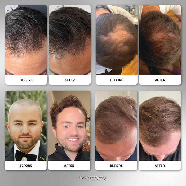 WELLBEL Men Clean Hair Supplement – 90 Capsules | Drug-Free Daily Formula to Support Hair Growth & Thickness