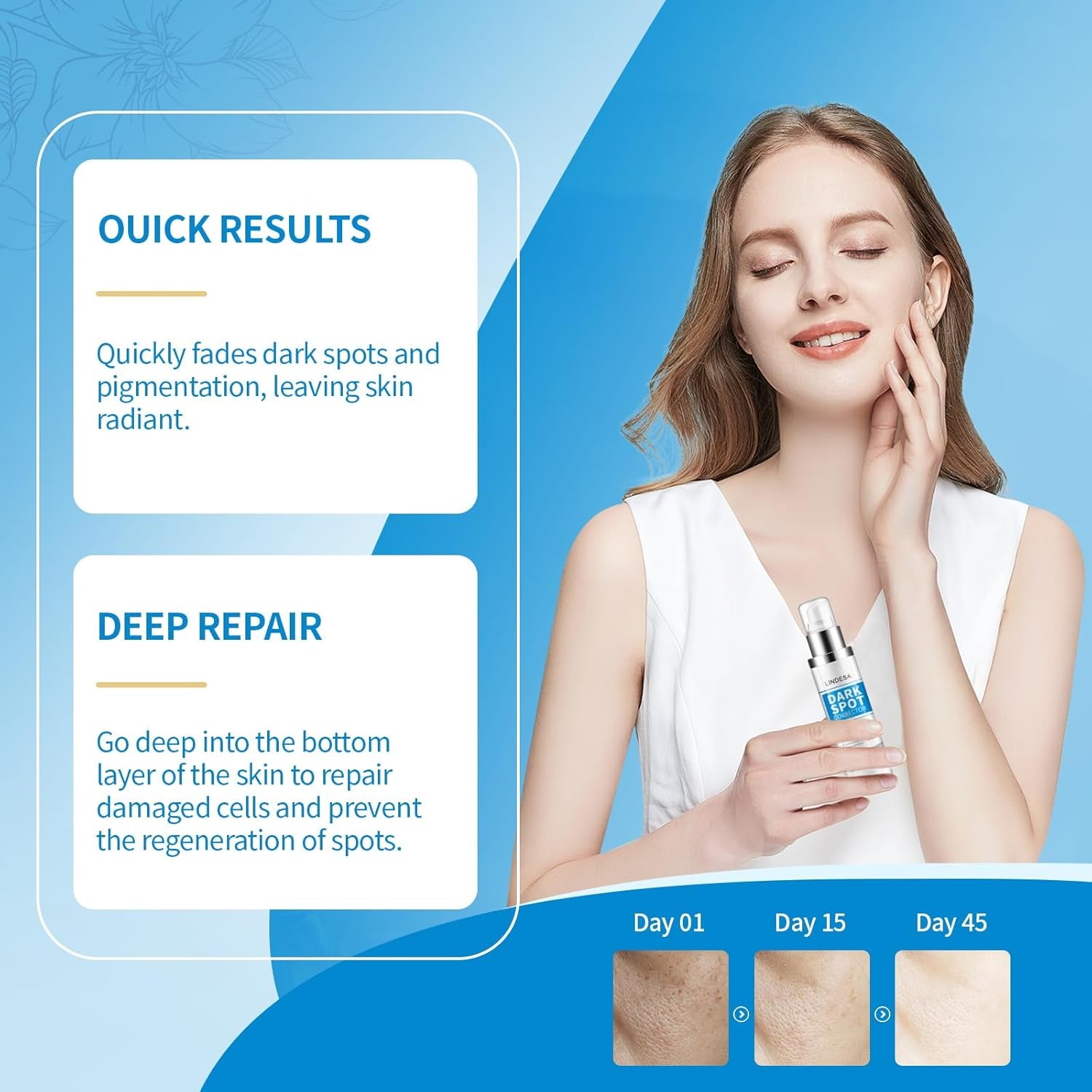 Lindesa Dark Spot Corrector – 30ml | Advanced Serum for Hyperpigmentation, Melasma, Sun Spots & Uneven Skin Tone