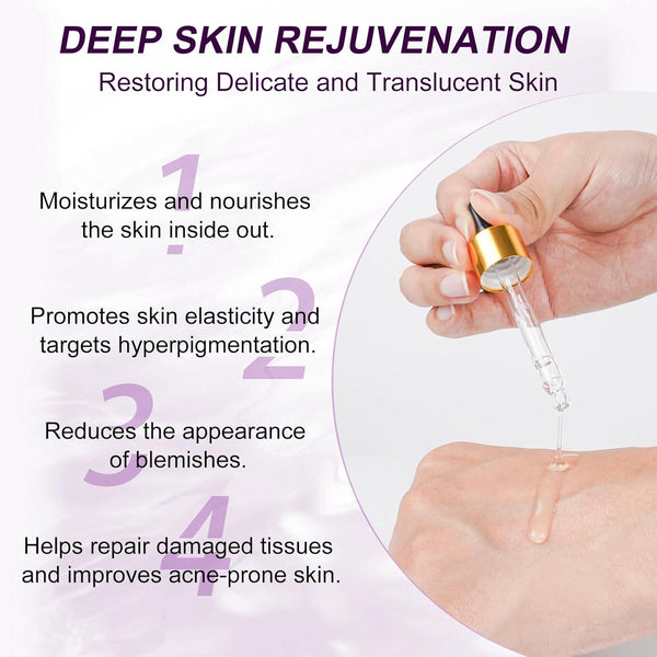 Netwik Azelaic Acid 10% Serum – 30ml | Redness Relief, Rosacea & Acne Treatment for Clear, Radiant Skin