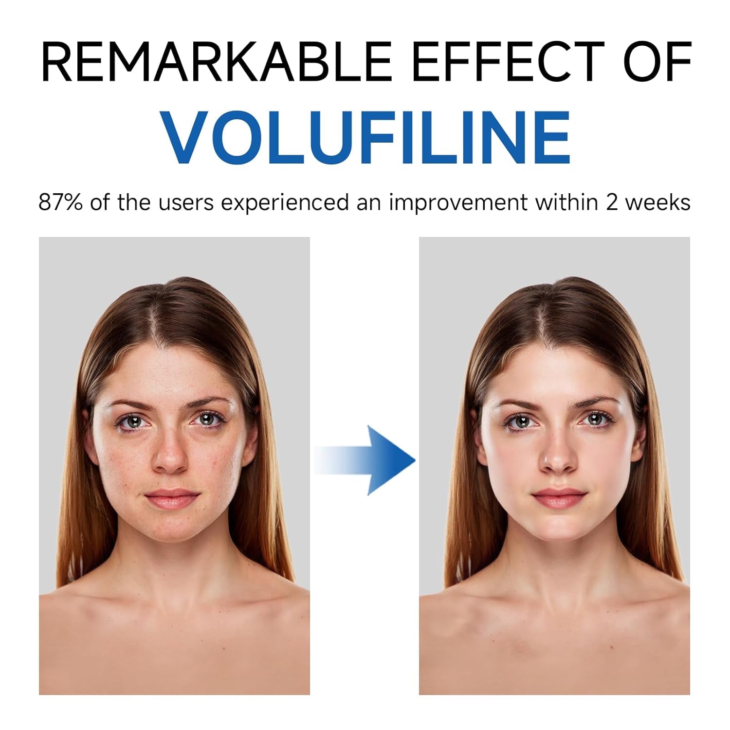VINDATE Volufiline Serum – 10ml x 2 Pieces | Customisable Plumping & Firming Booster