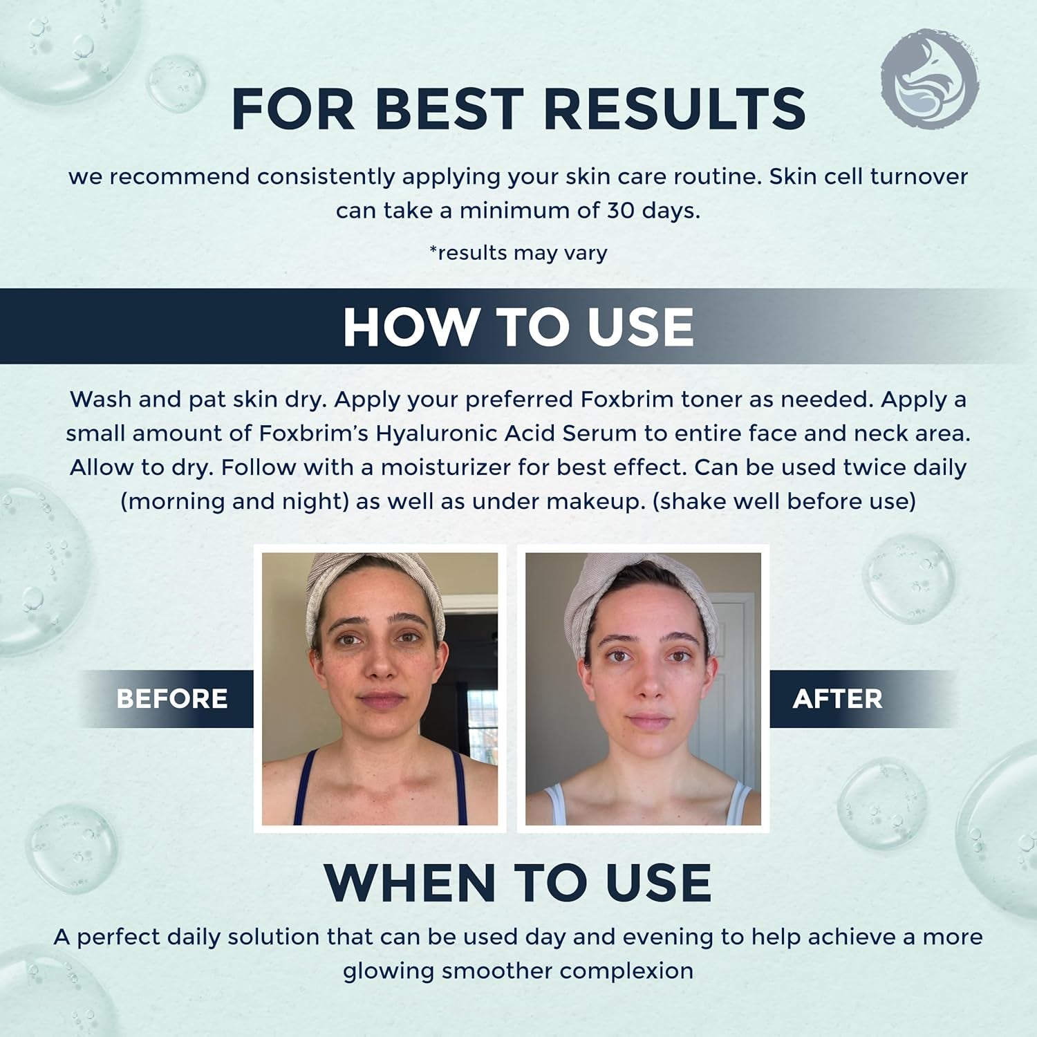 Foxbrim Naturals Hyaluronic Acid Serum – 30ml | Deep Hydration & Anti-Aging Care