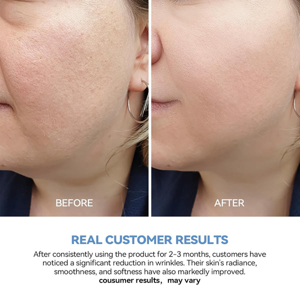 WNP 3% Hyaluronic Acid Serum Ultra-Hydrating Capsule – 30 x 1.2ml | Lightweight, Deep Moisture Ampoule for All Skin Types