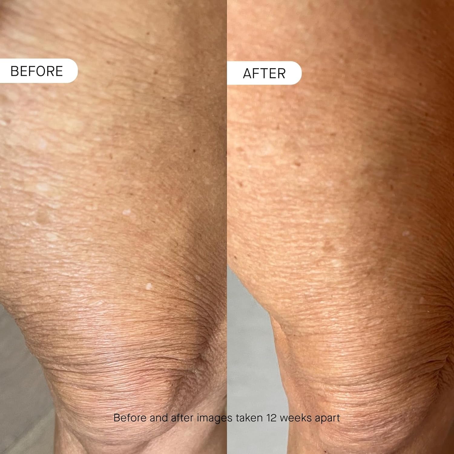OneSkin BODY OS-01 Topical Supplement – 250ml | Age-Defying Body Moisturizer with OS-01 Peptide & Ceramides