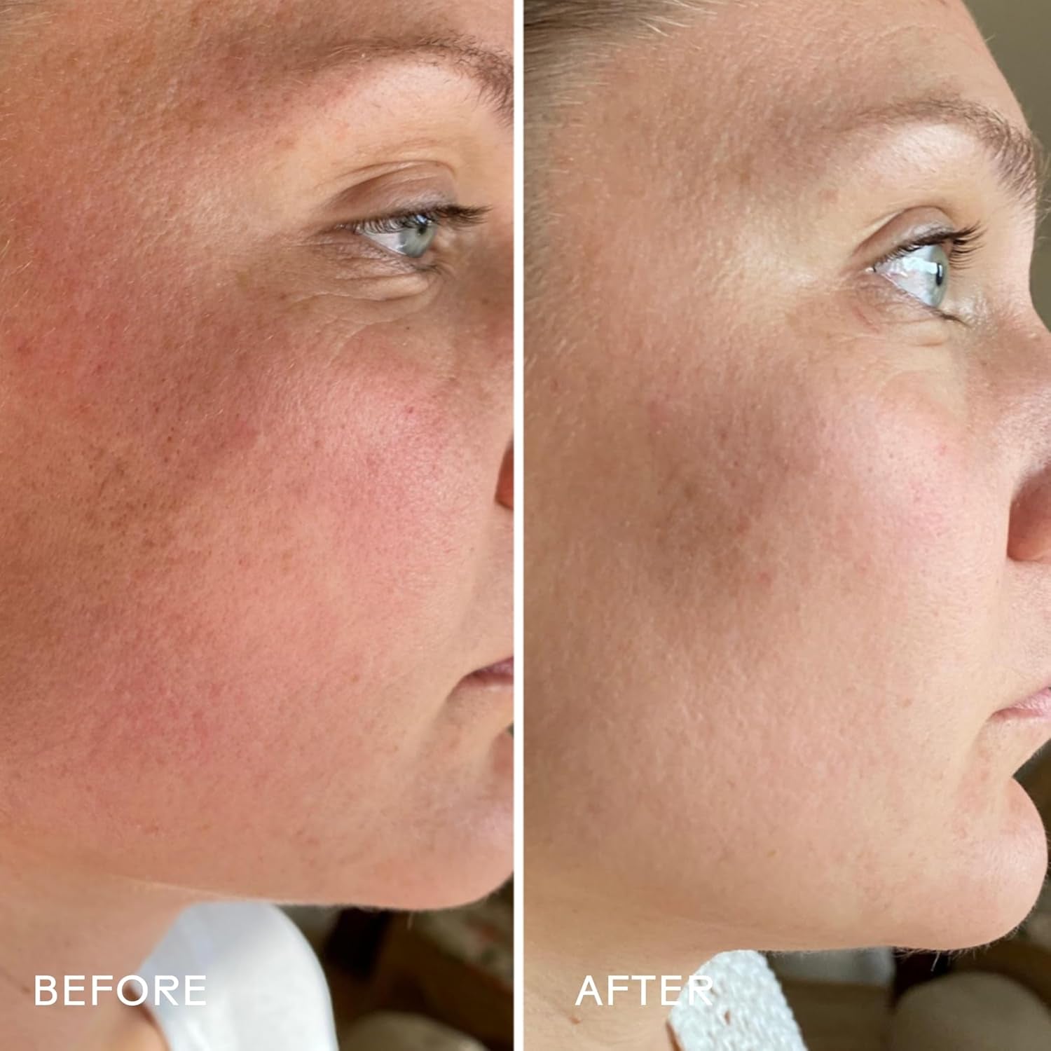 - Skinhero Calendula + 2% Bakuchiol Bio-Retinol Serum | Firm, Soothe, Hydrate Skin | Cruelty-Free, Vegan, Paraben-Free, Sensitive Skin Safe (1 Fl Oz | 30 Ml)