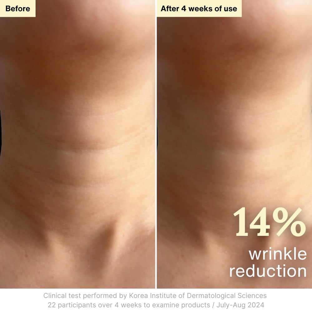 Rothea Resilience Cream – 50ml | Clinically Proven Wrinkle Reduction & 72-Hour Hydration