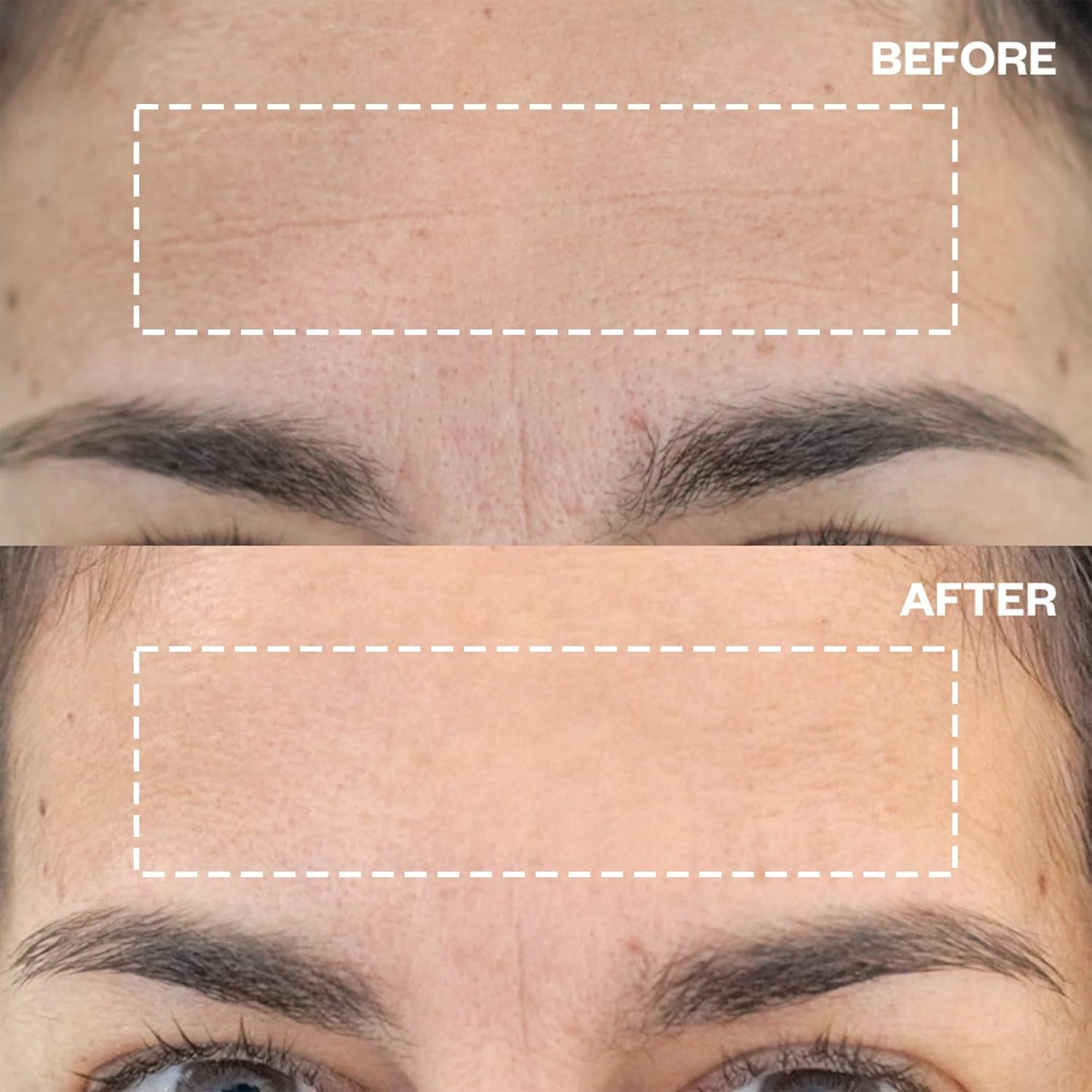 Wrinkles Schminkles Forehead Wrinkle Patches – 1 Pad (2 Packs) | Non-Invasive Line-Smoothing Treatment for Forehead & Frown Lines