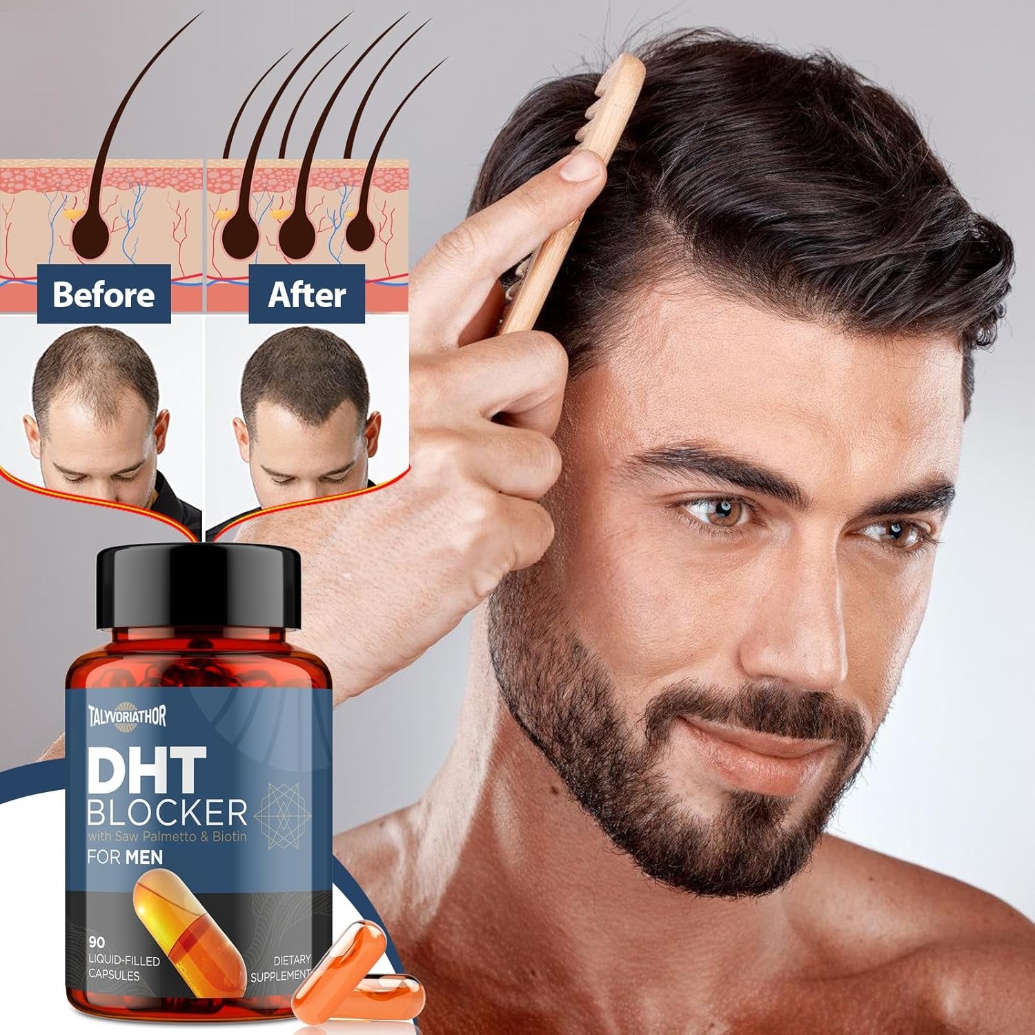 Talyvoriathor DHT Blocker with Saw Palmetto & Biotin for Men – 90 Capsules | Supports Hair Growth, Thicker Hair & Scalp Health