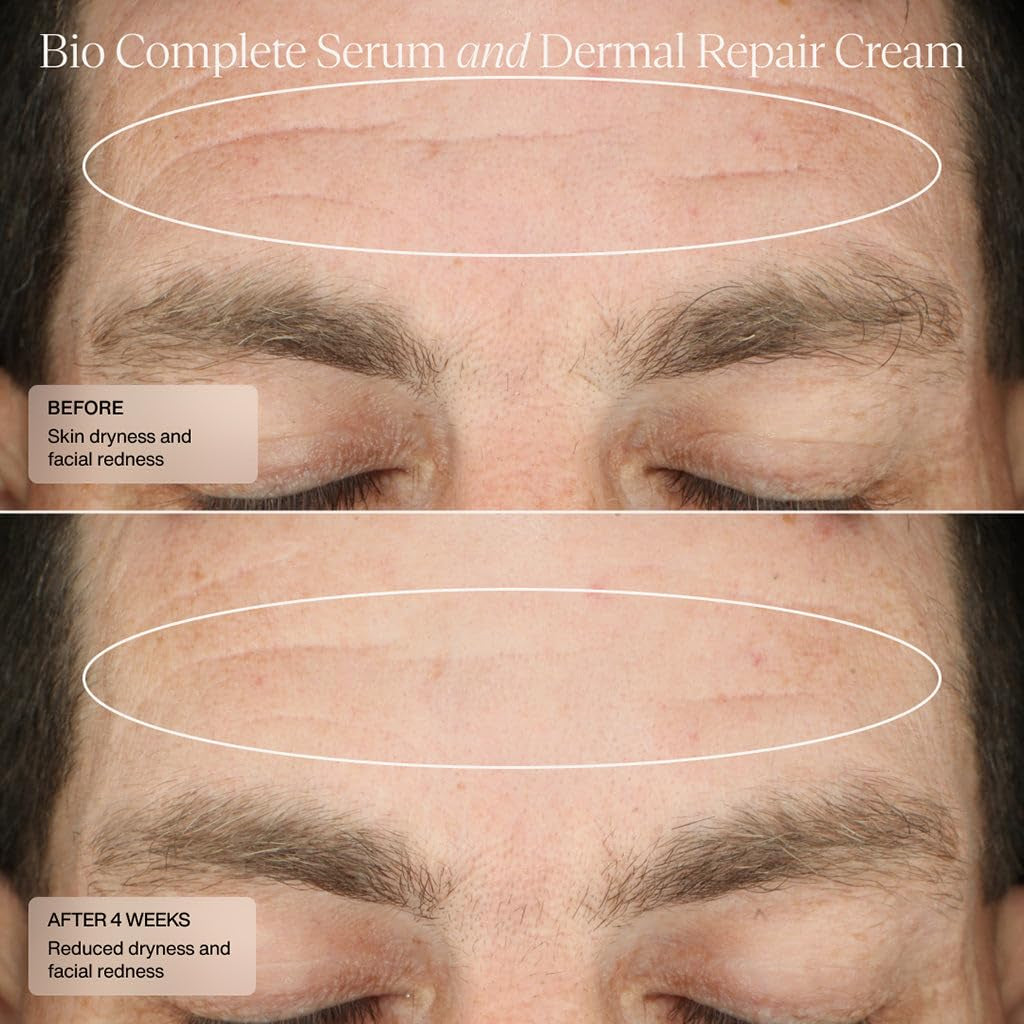 Senté Bio Complete Serum – 30ml | Gentle Retinoid for Fine Lines & Even Skin Tone