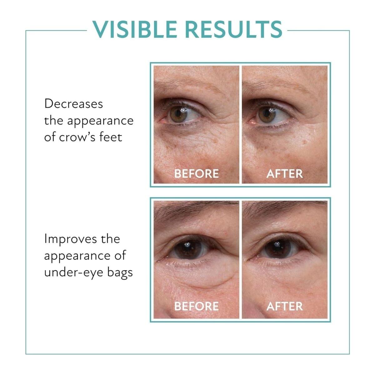 60 Second Eye Effects - Eye Tightening Serum Instant - Instant Eye Tightener - Instant Eye Bag Remover Puffiness - Instant Firming Eye Cream - Instant Face Lift Serum - Glam Global UK