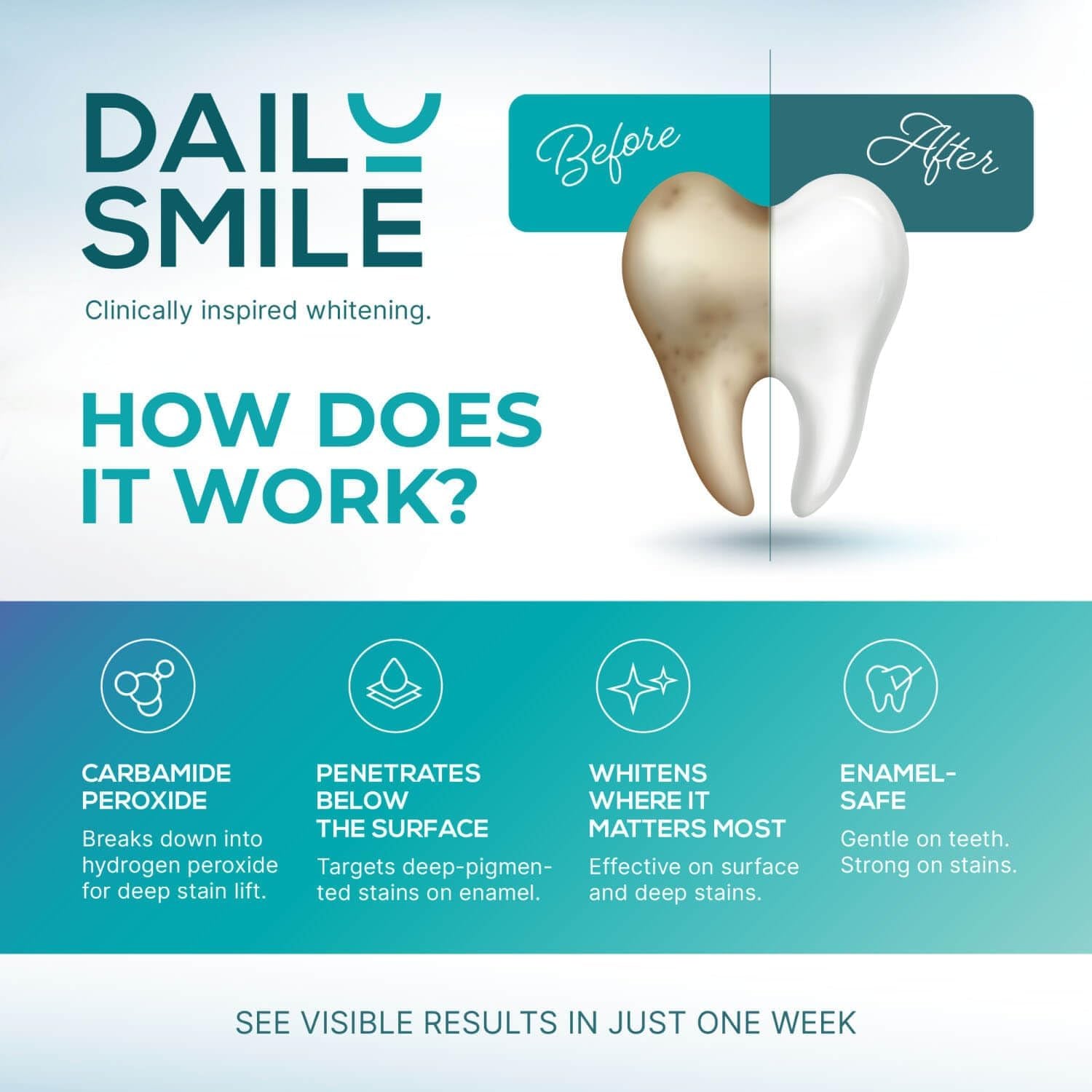 Dailysmile Teeth Whitening Kit with LED - Formulated for Sensitive Teeth, Hands-Free, Waterproof LED Light and 4 Gel Pens, Instant Results