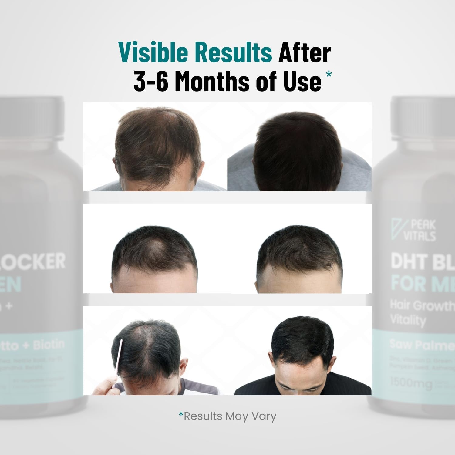 PEAK VITALS DHT Blocker for Men – 90 Capsules | Hair Regrowth Supplement with Biotin, Saw Palmetto & Adaptogens