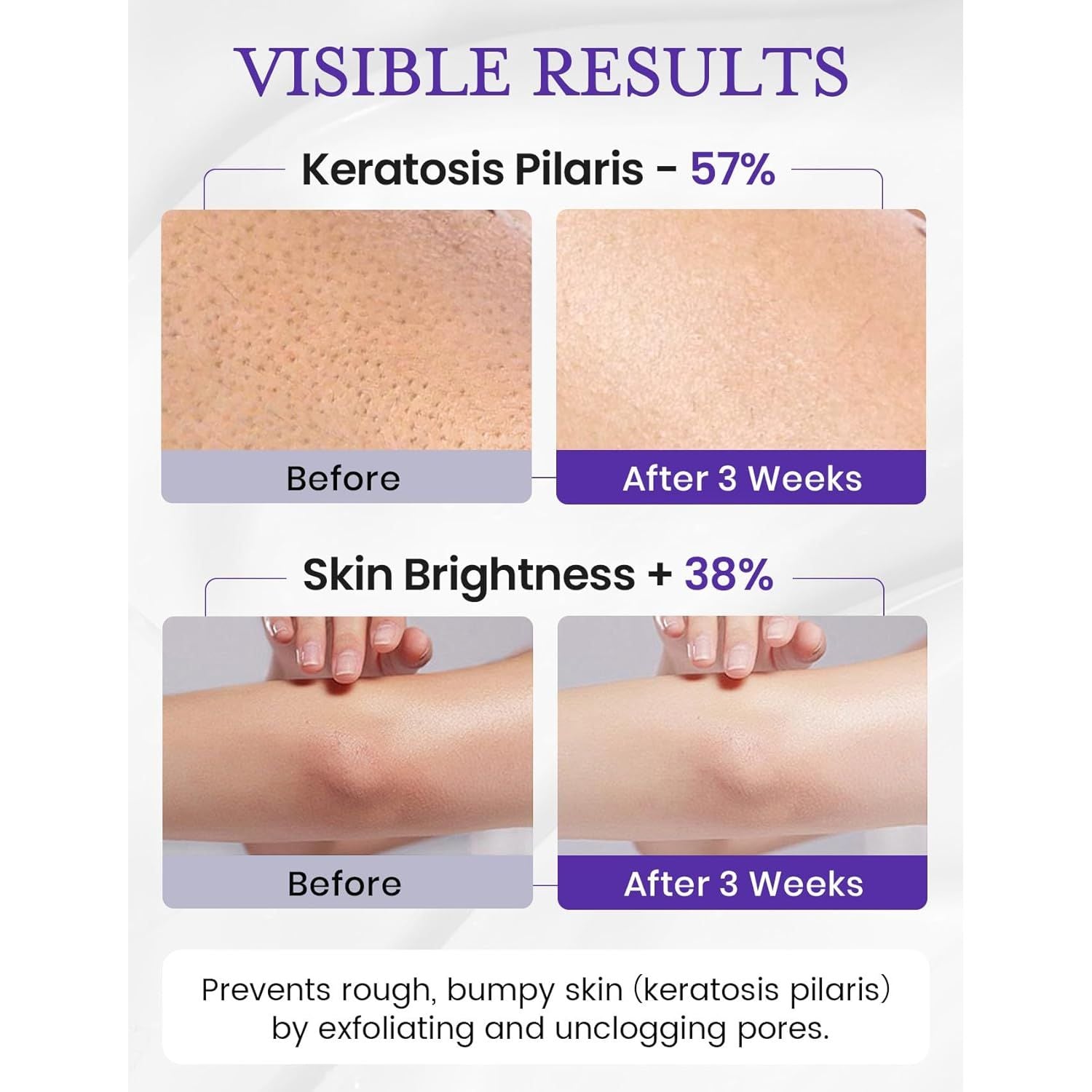 Elvira Double-Tube Body Scrub 10% BHA + AHA