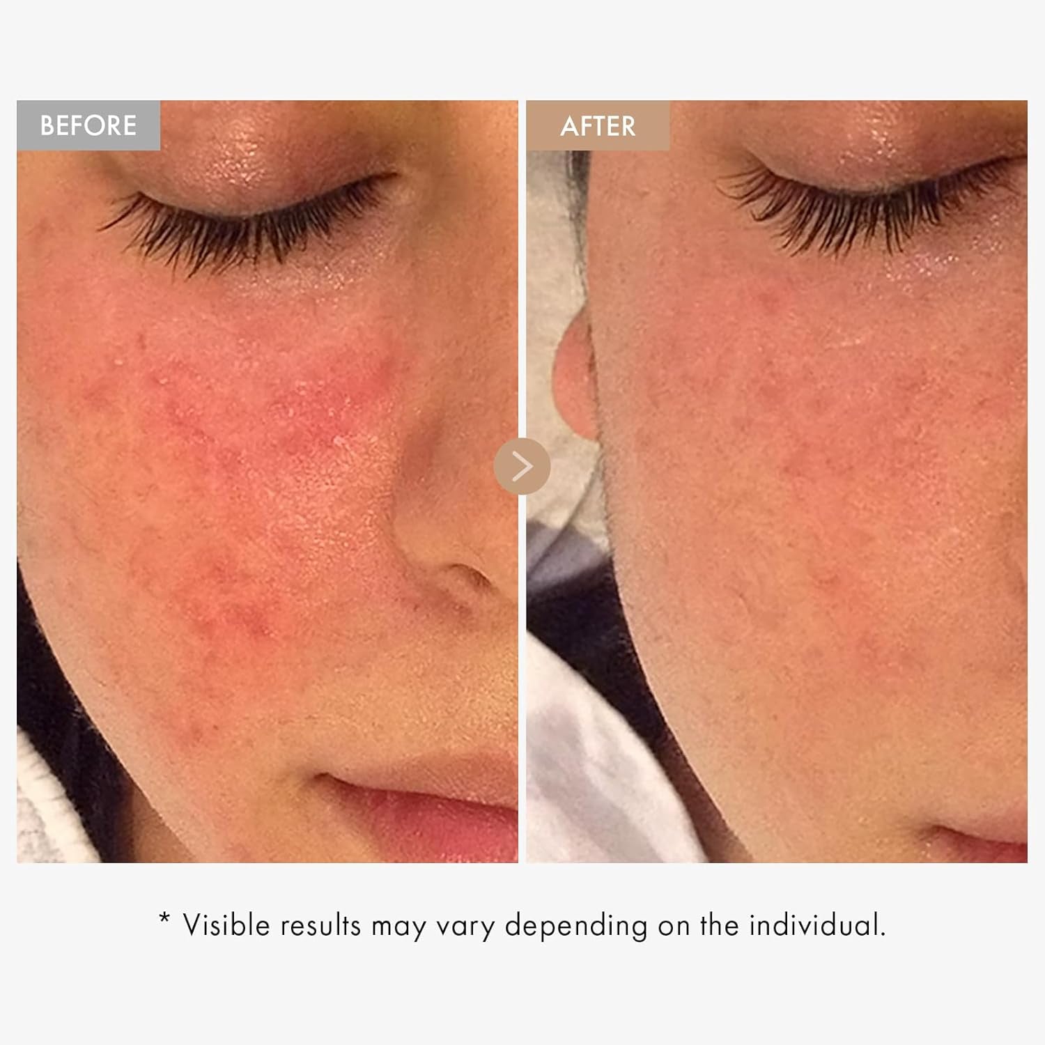 Real Oatmeal Relief Cream, Daily Face Moisturizer, Blemish Relief Care, Soothing Recovery, Moisture, Colloidal Oatmeal, Ceramide, Panthenol, Hyaluronic Acid, Korean Skincare 50Ml 1.69 Fl.Oz.