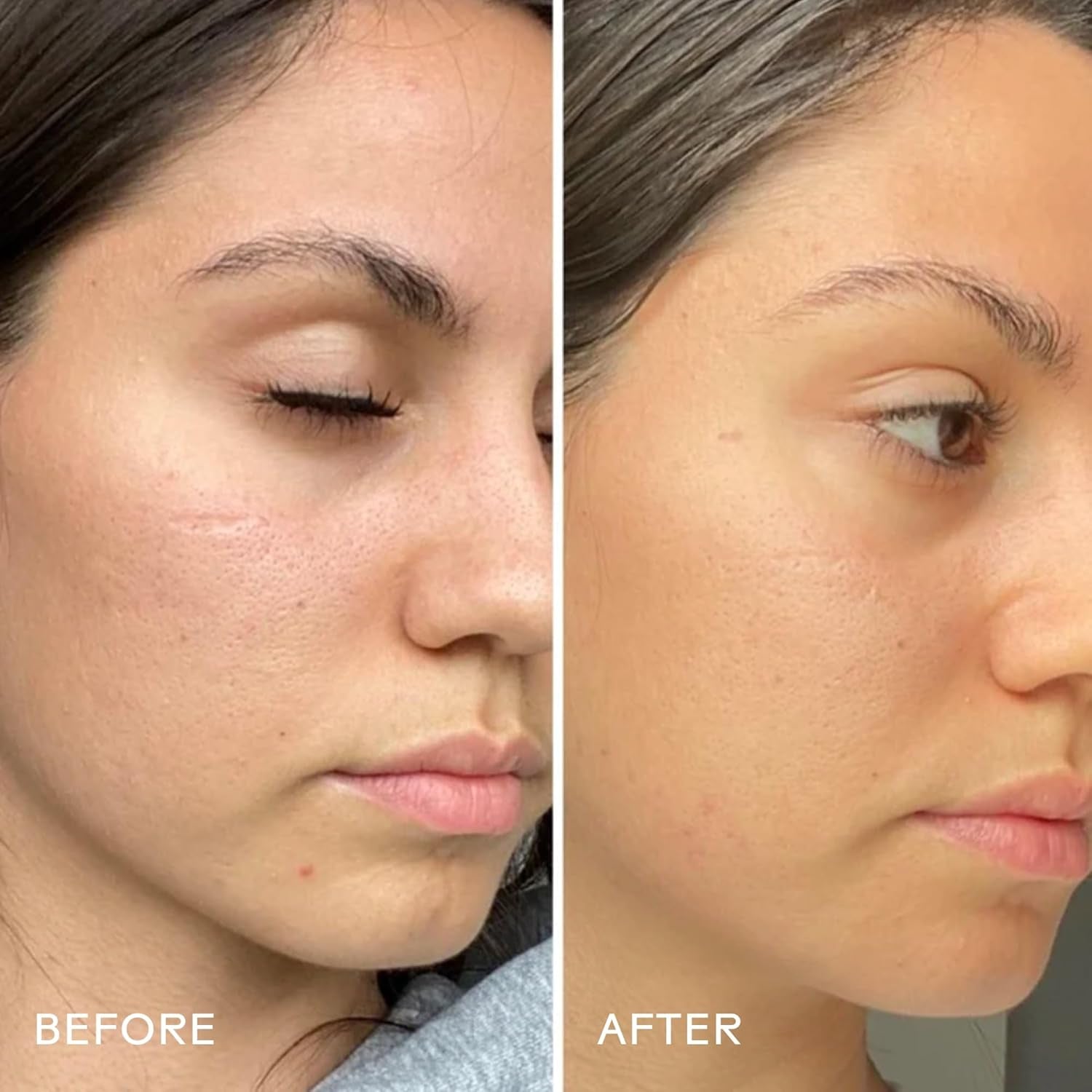 - Glow 49% Jojoba Oil Serum | Helps Balance Skin, Control Oil, + Minimize the Look of Pores | Cruelty-Free, Vegan, Paraben-Free, Sensitive Skin Safe (1 Fl Oz | 30 Ml)