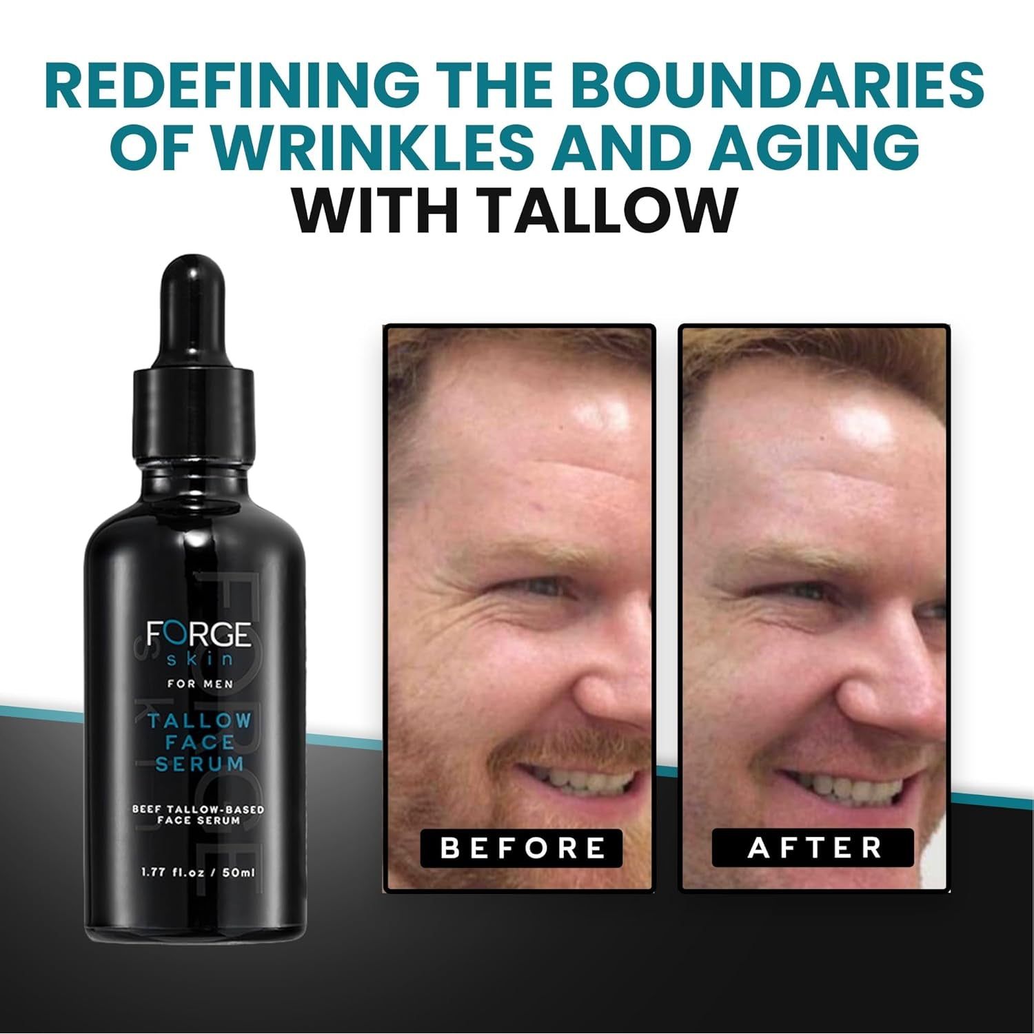 Forge Skin Tallow Face Serum for Men – 50ml | Anti-Aging Night Repair with Beef Tallow & Hyaluronic Acid