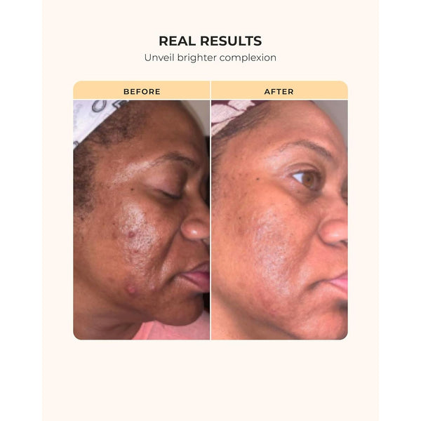 buttah. by Dorion Renaud Skin Transforming Kit | CocoShea Cream | Brightening, Hydration & Glow for Melanin-Rich Skin