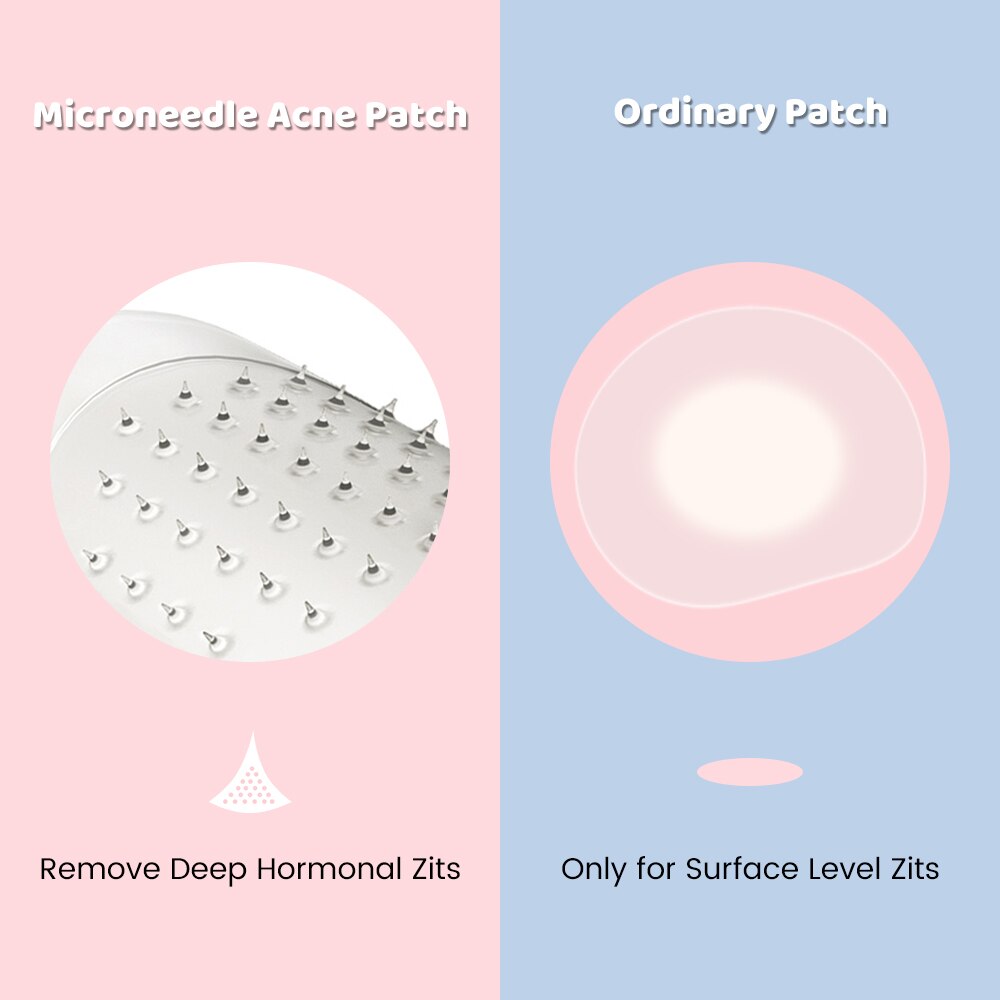 Microneedle Pimple Patch 9 Pcs - Fast Healing Repair